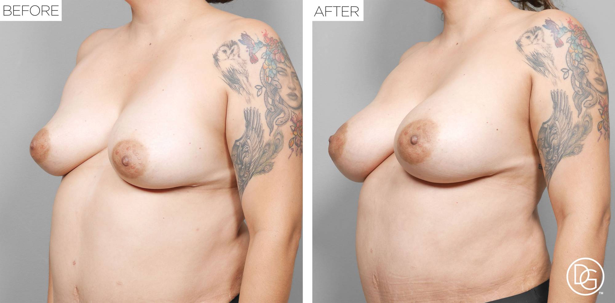 Before & After Image