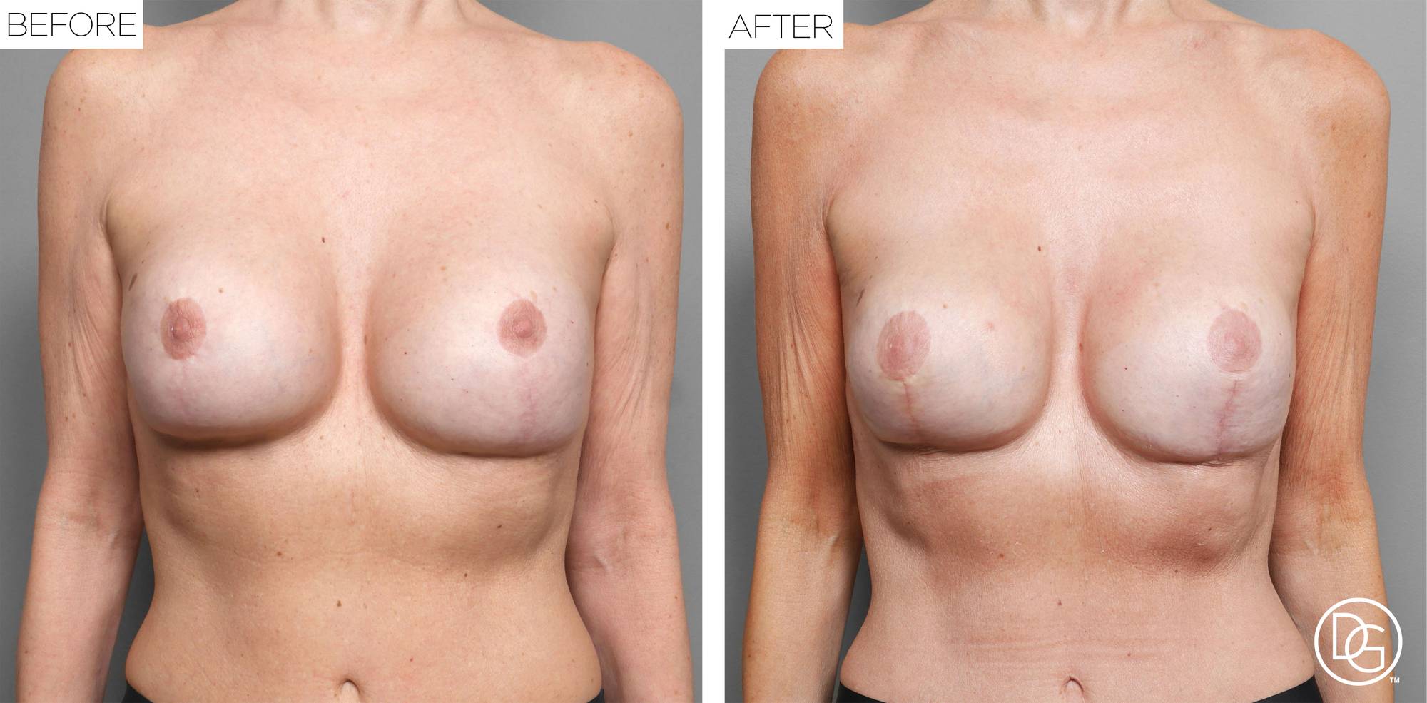 Before & After Image