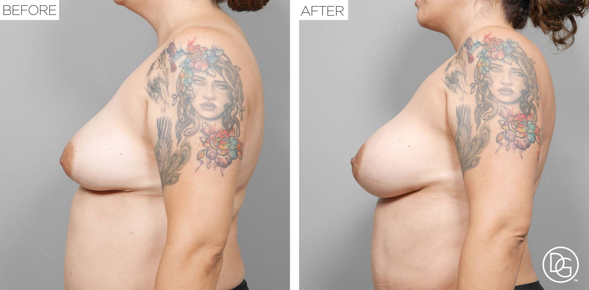 Before & After Image