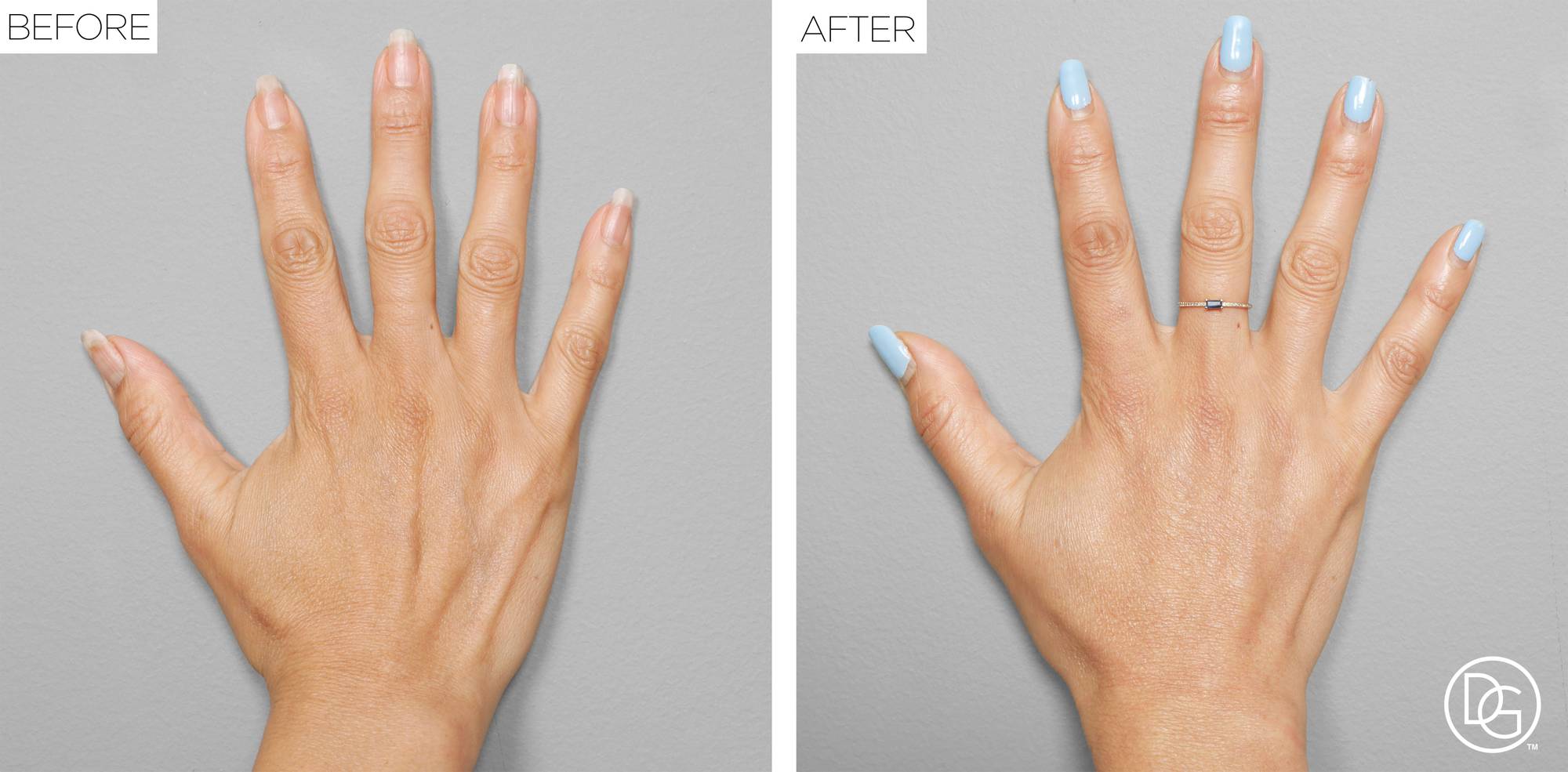 Before & After Image