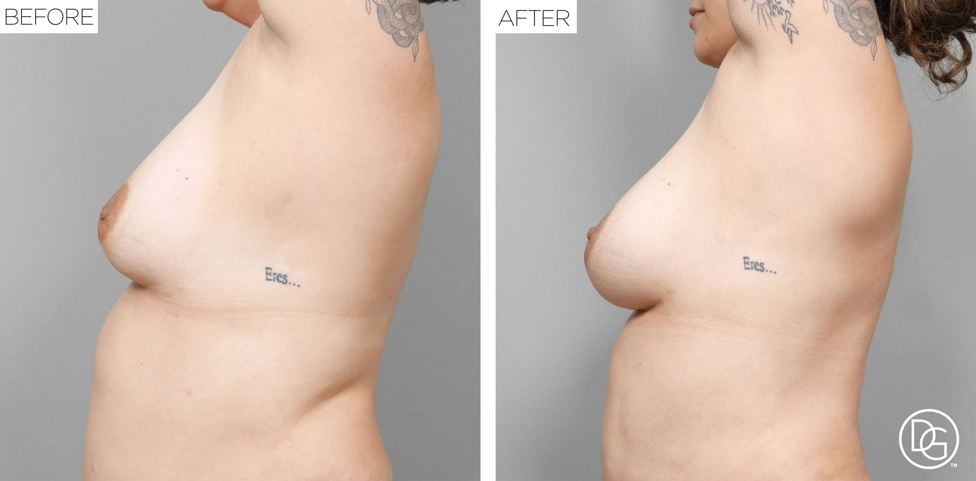 Before & After Image