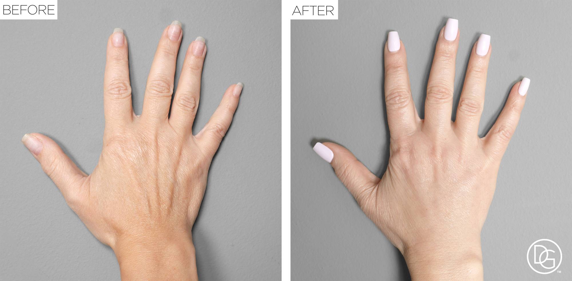 Before & After Image