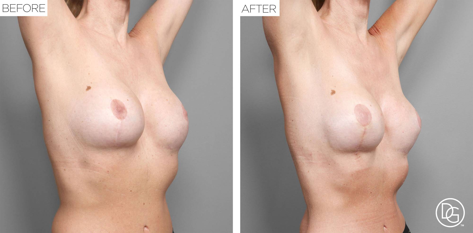 Before & After Image