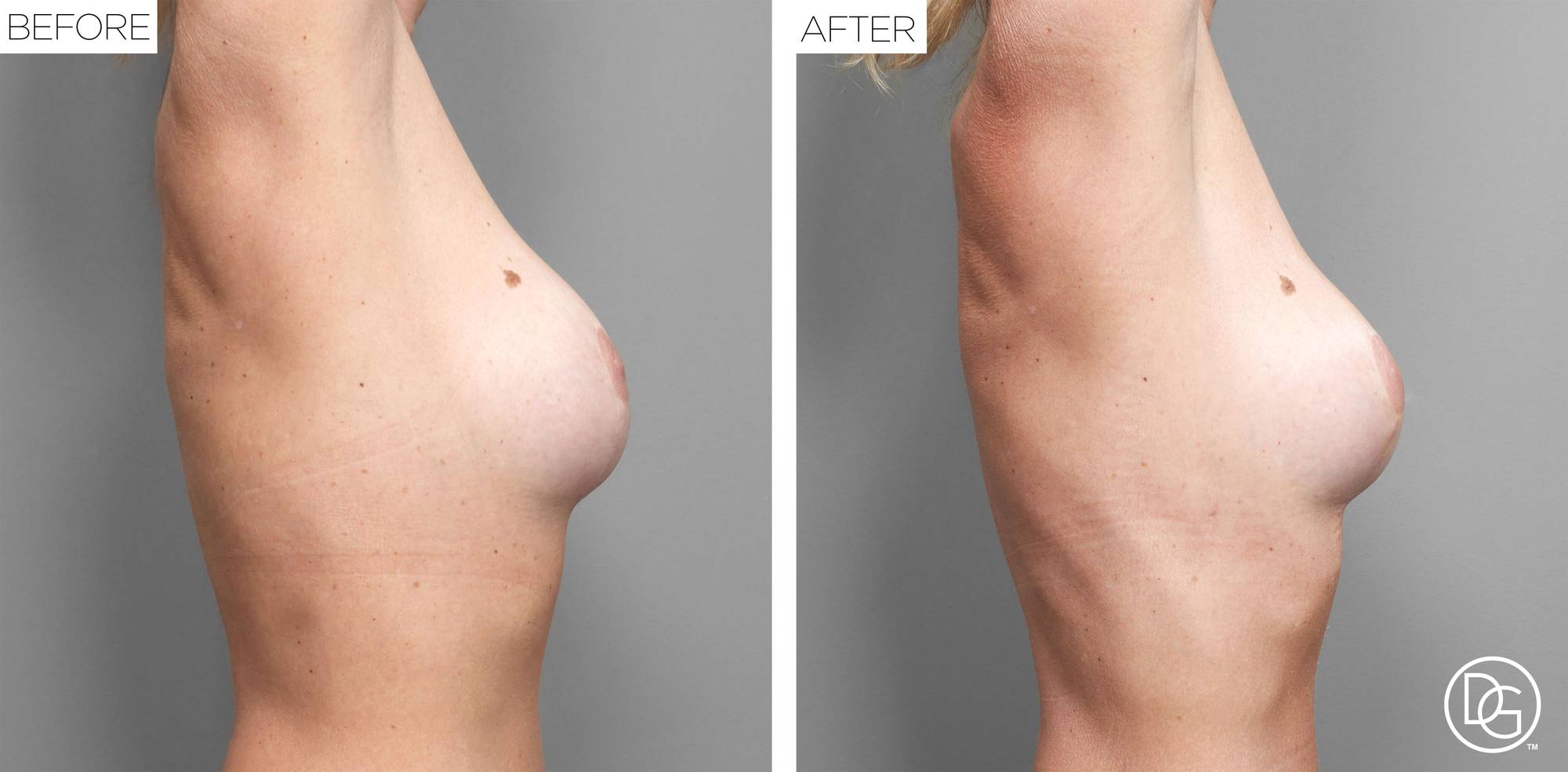 Before & After Image