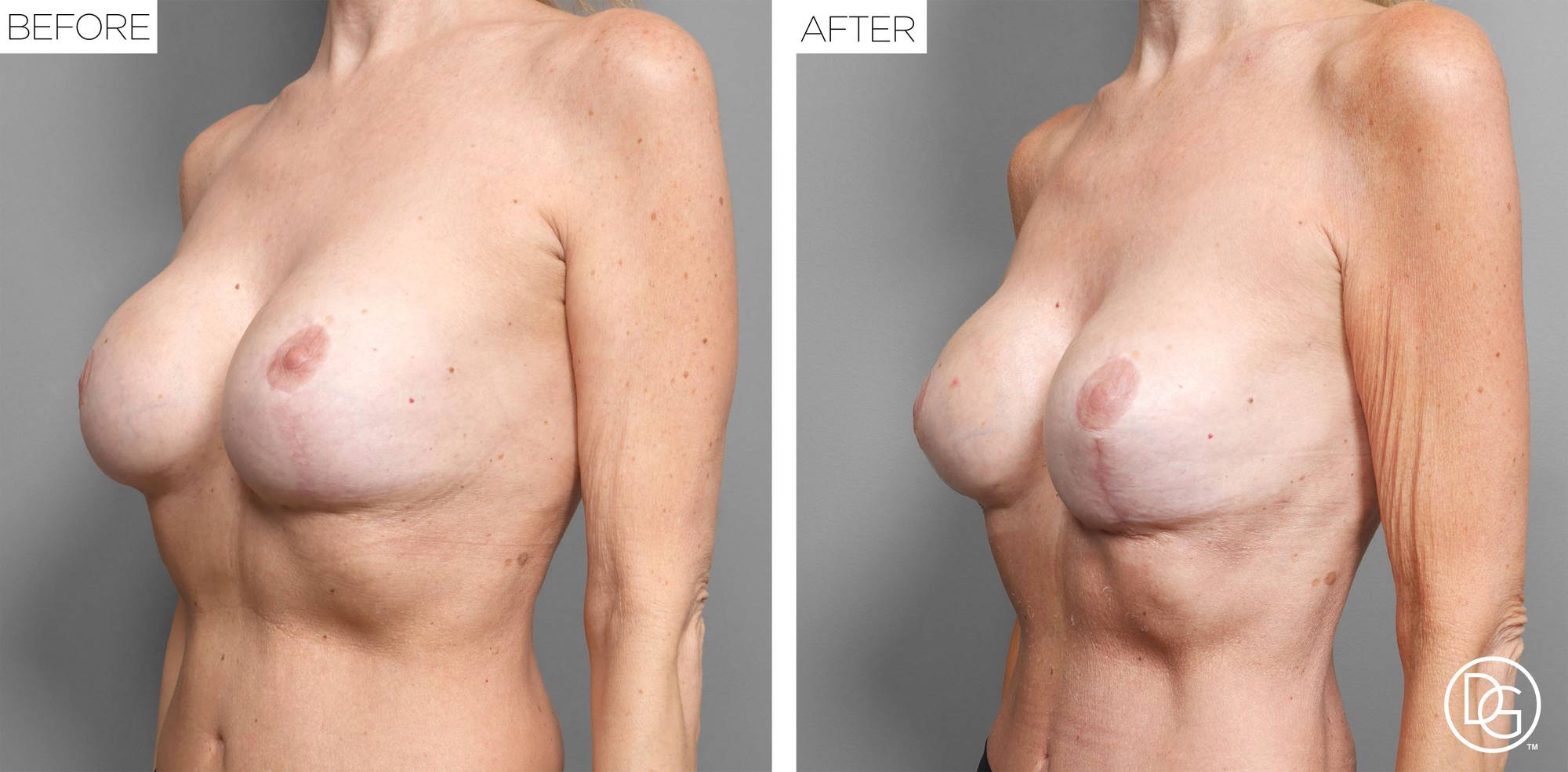 Before & After Image