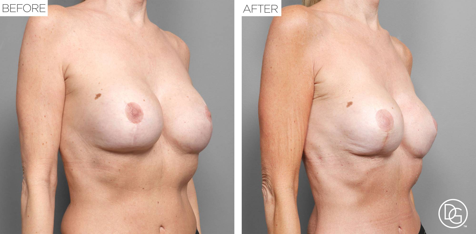 Before & After Image