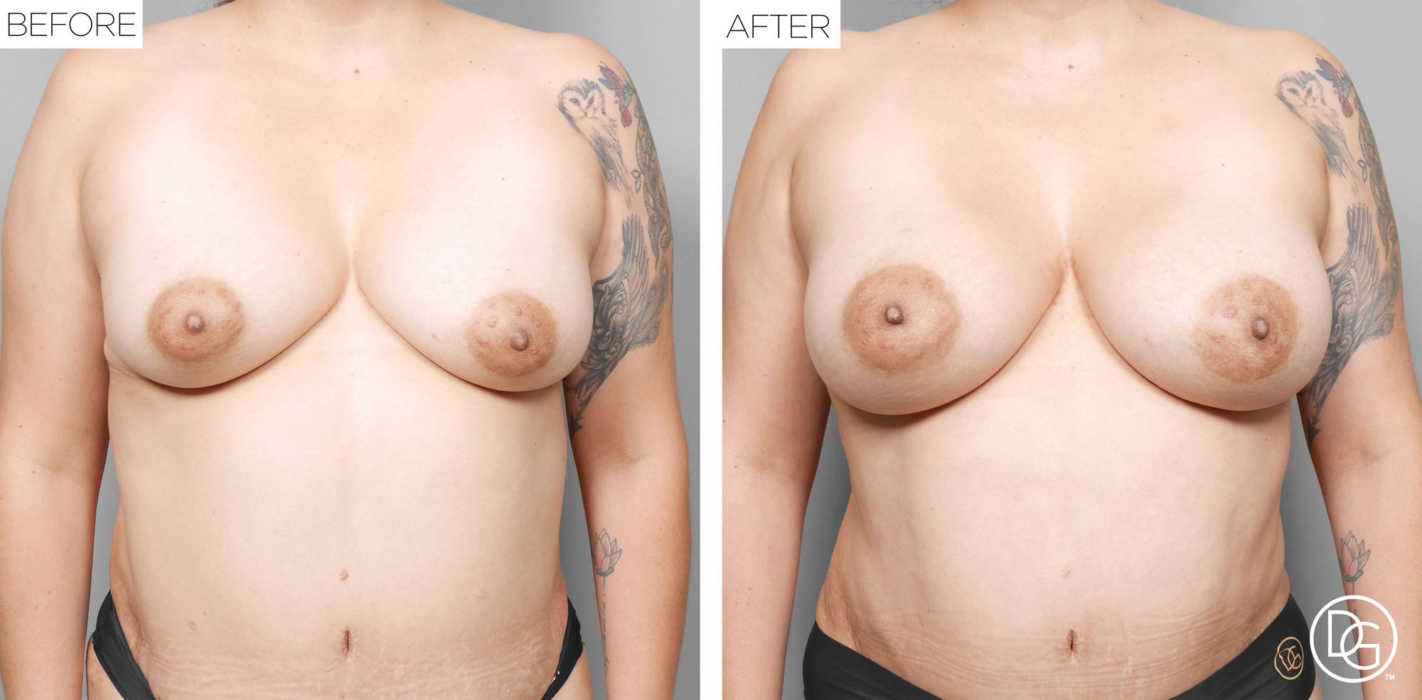 Before & After Image