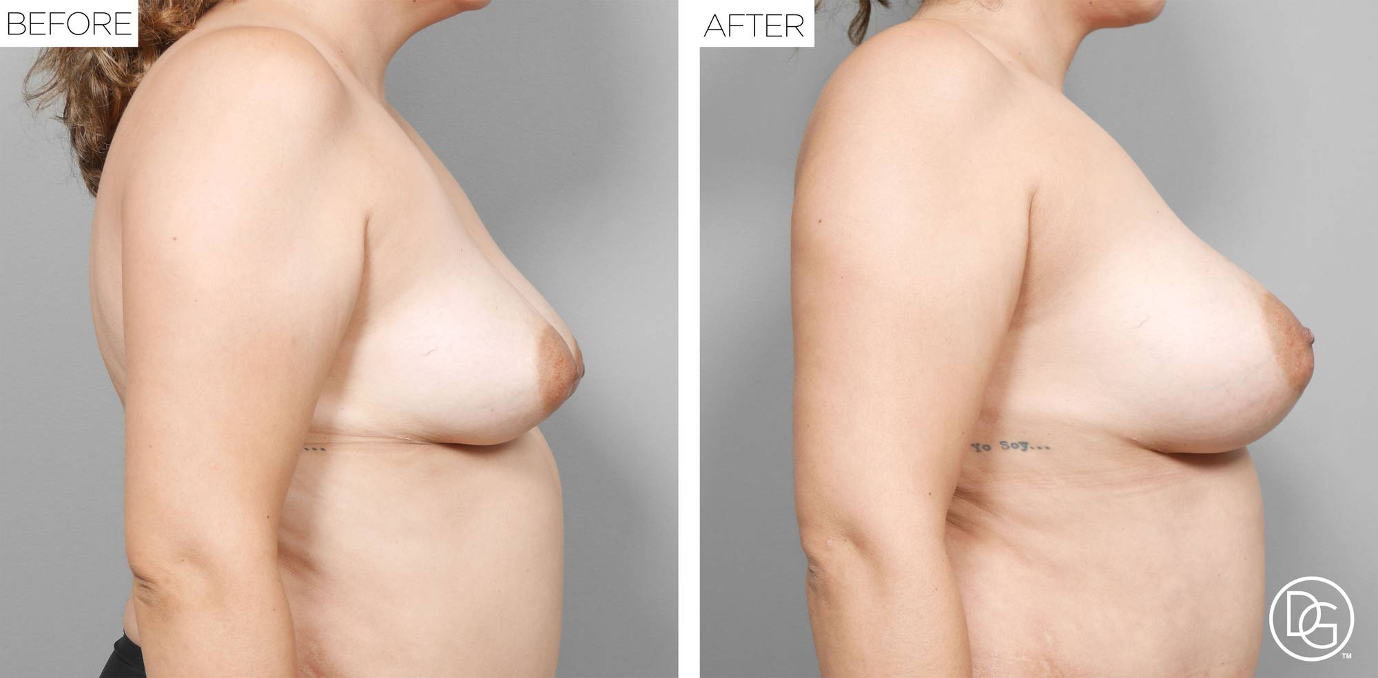 Before & After Image