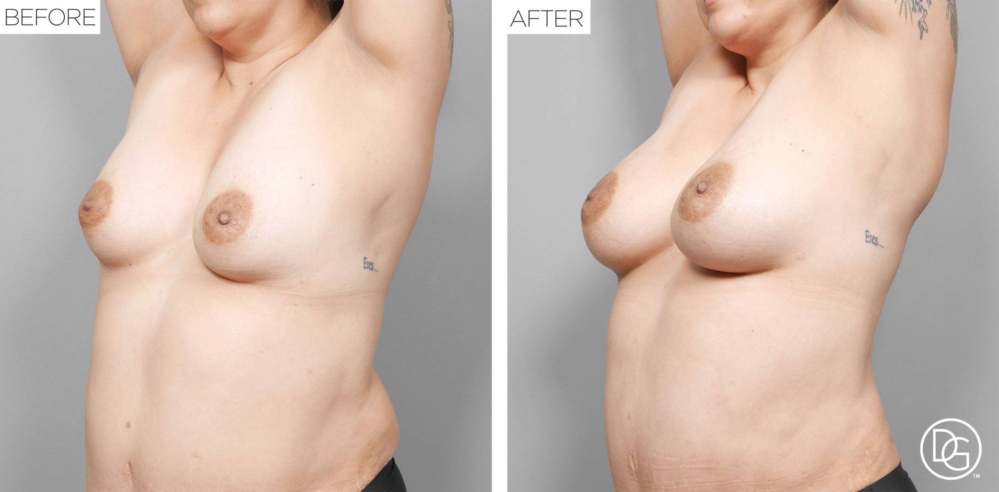 Before & After Image