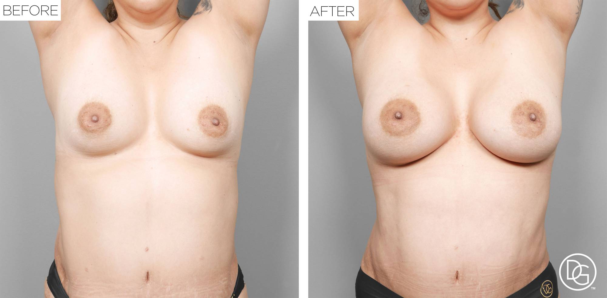 Before & After Image