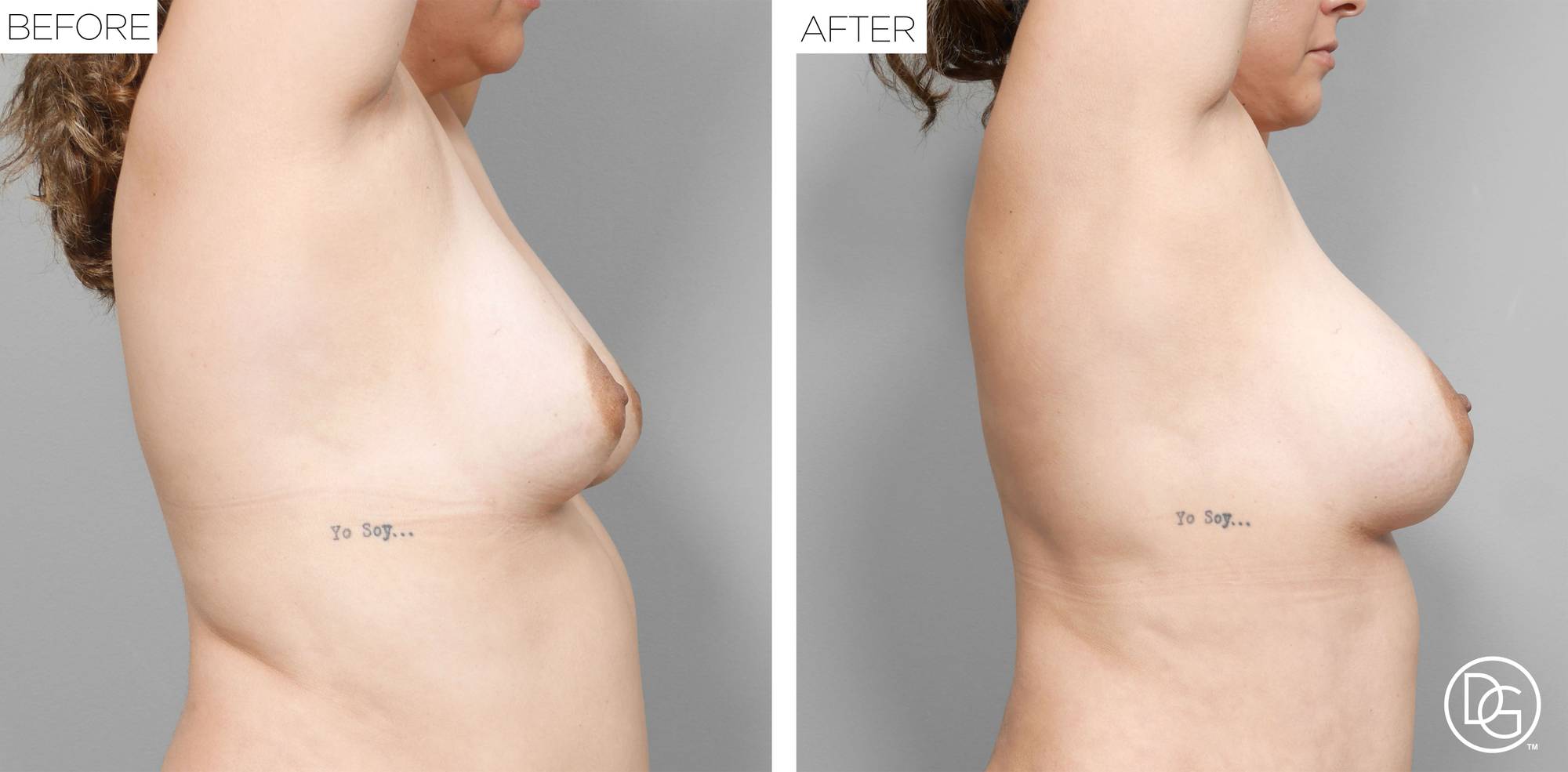 Before & After Image