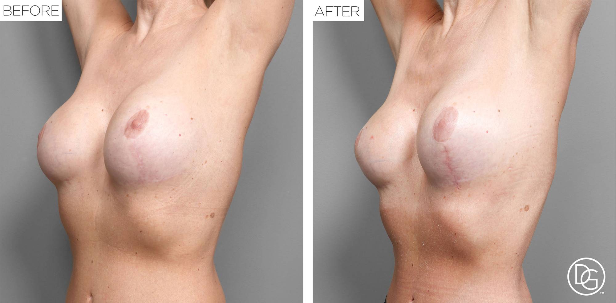 Before & After Image