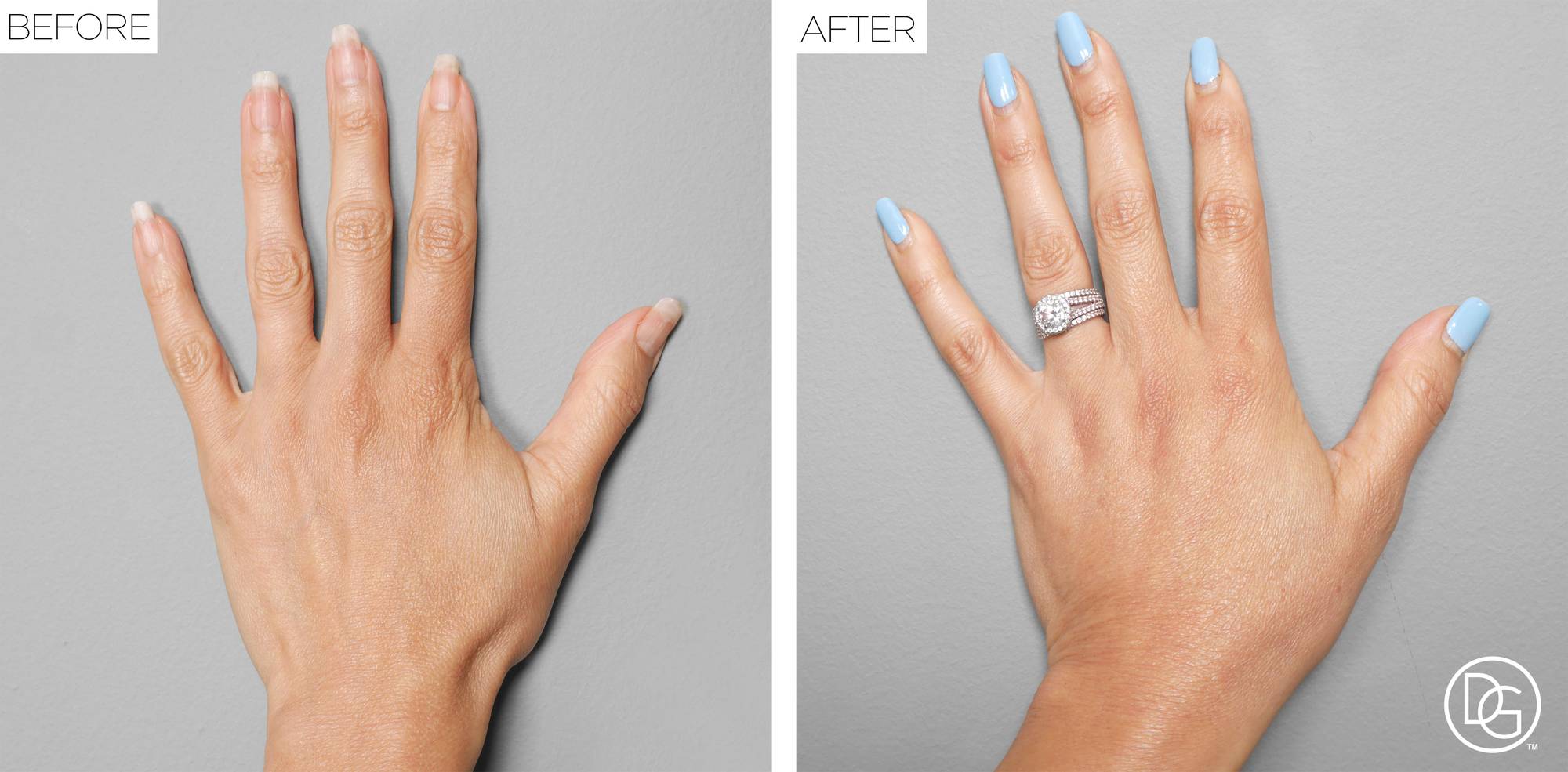 Before & After Image