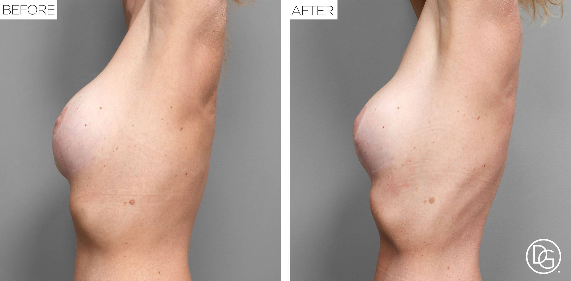 Before & After Image