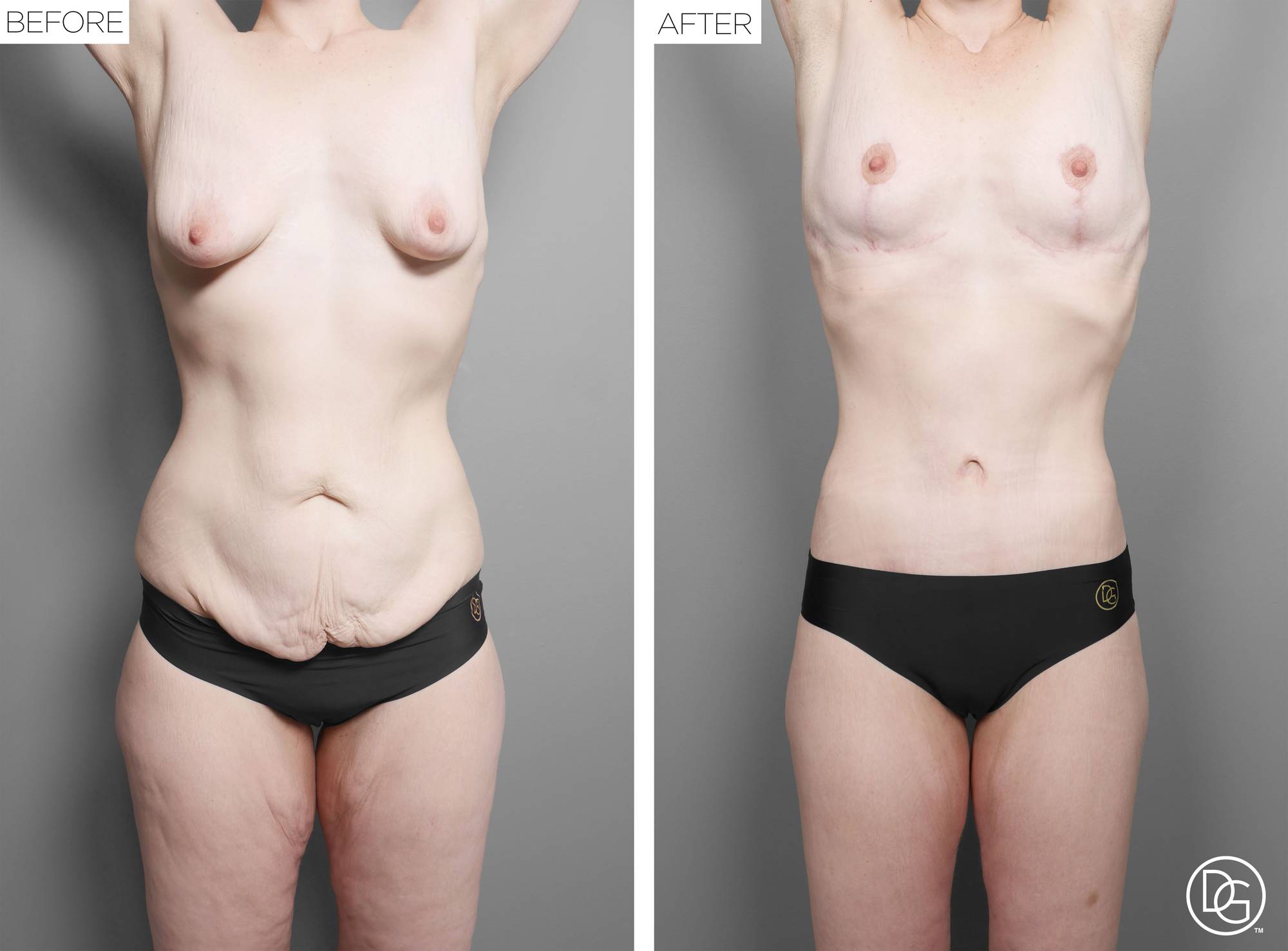 Before & After Image