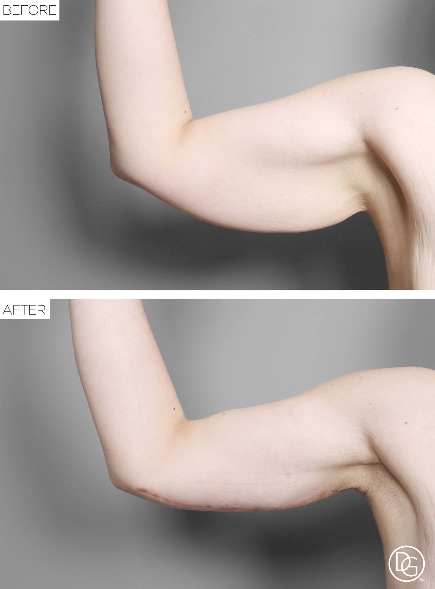 Before & After Image