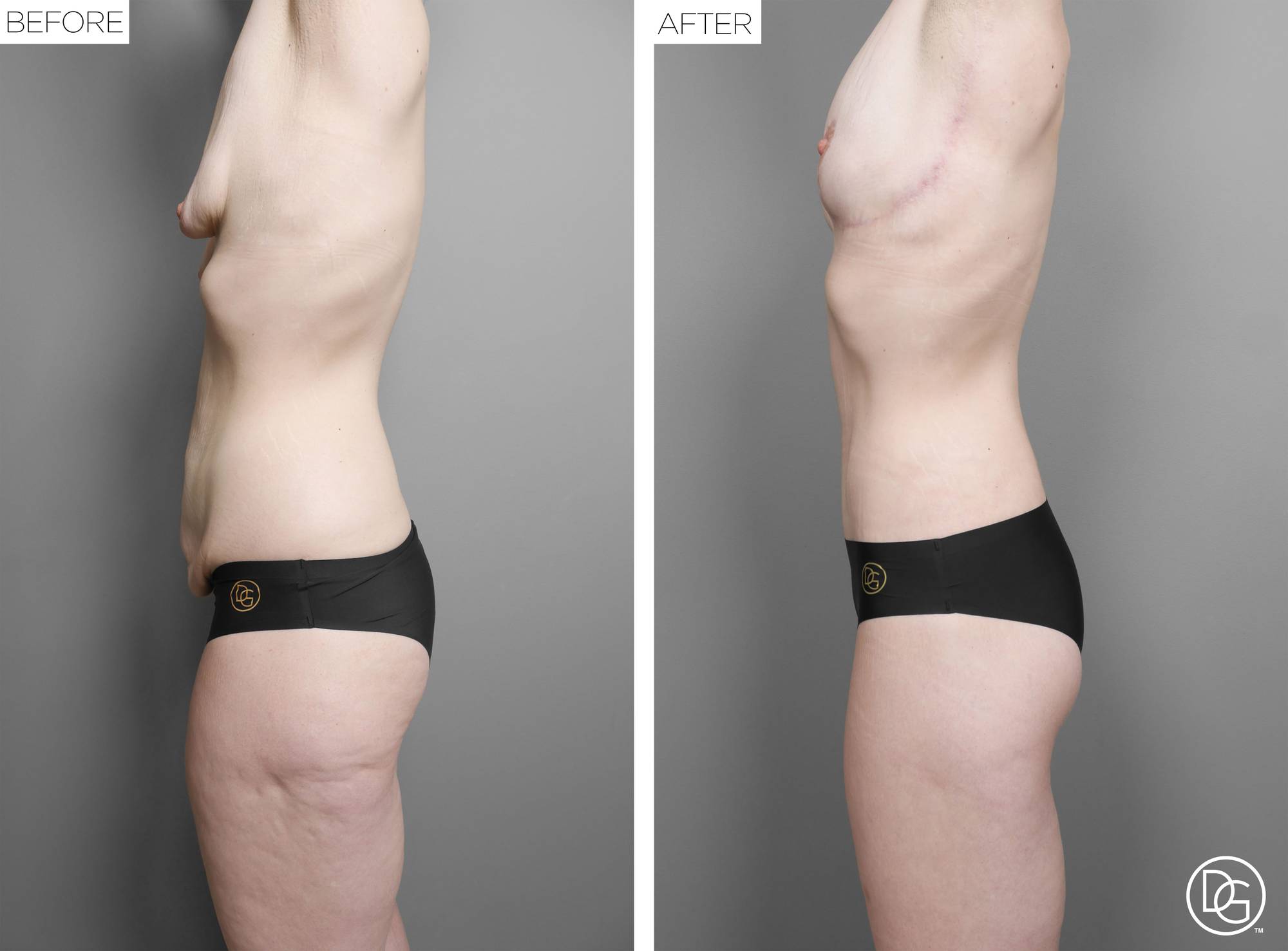 Before & After Image