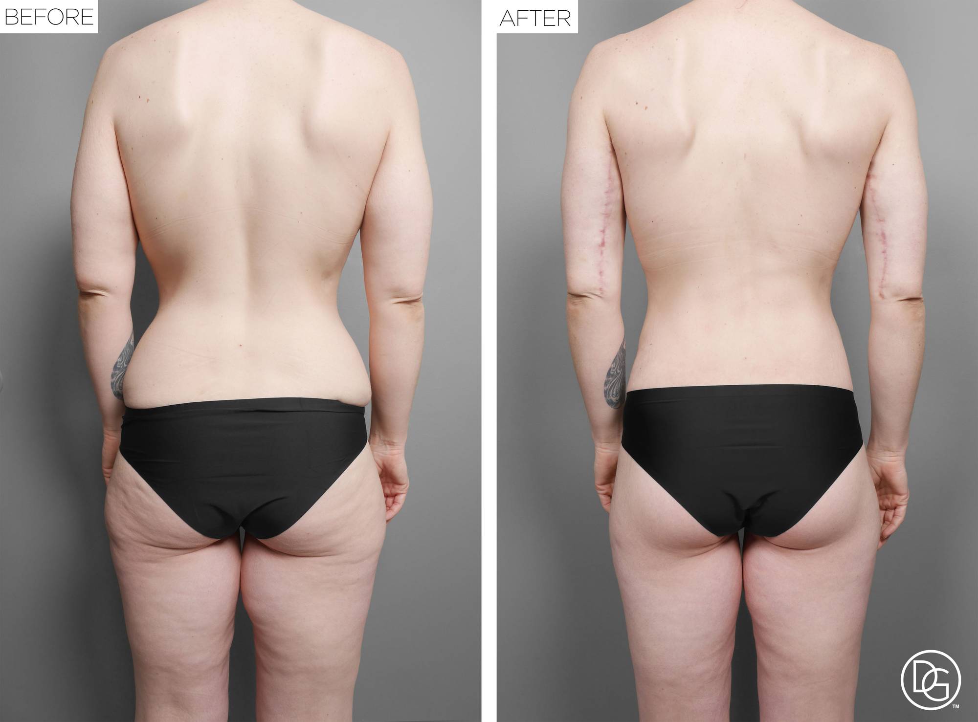 Before & After Image