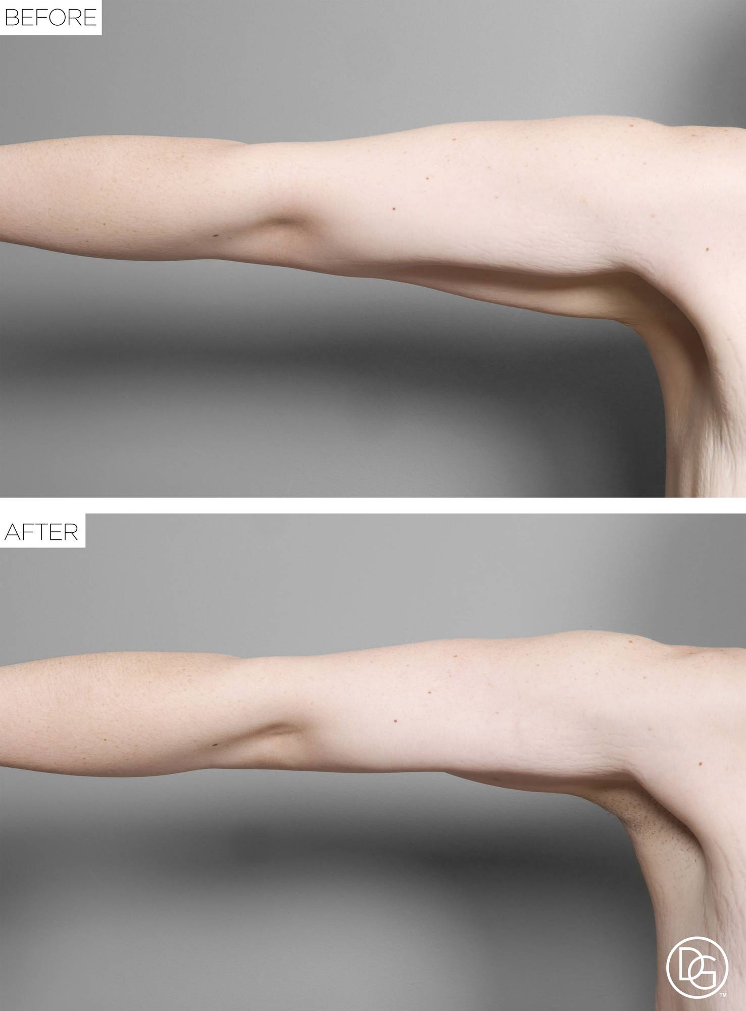 Before & After Image