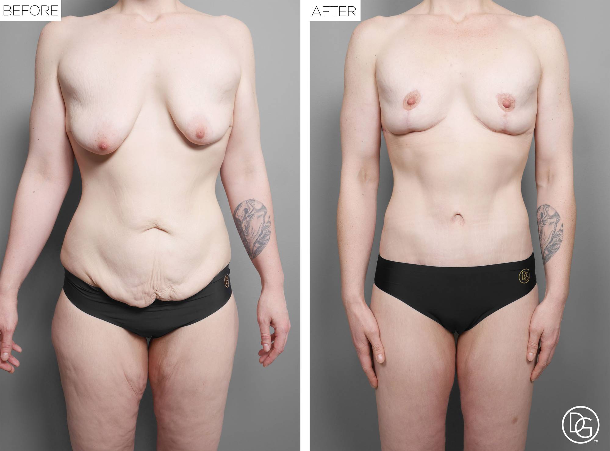 Before & After Image