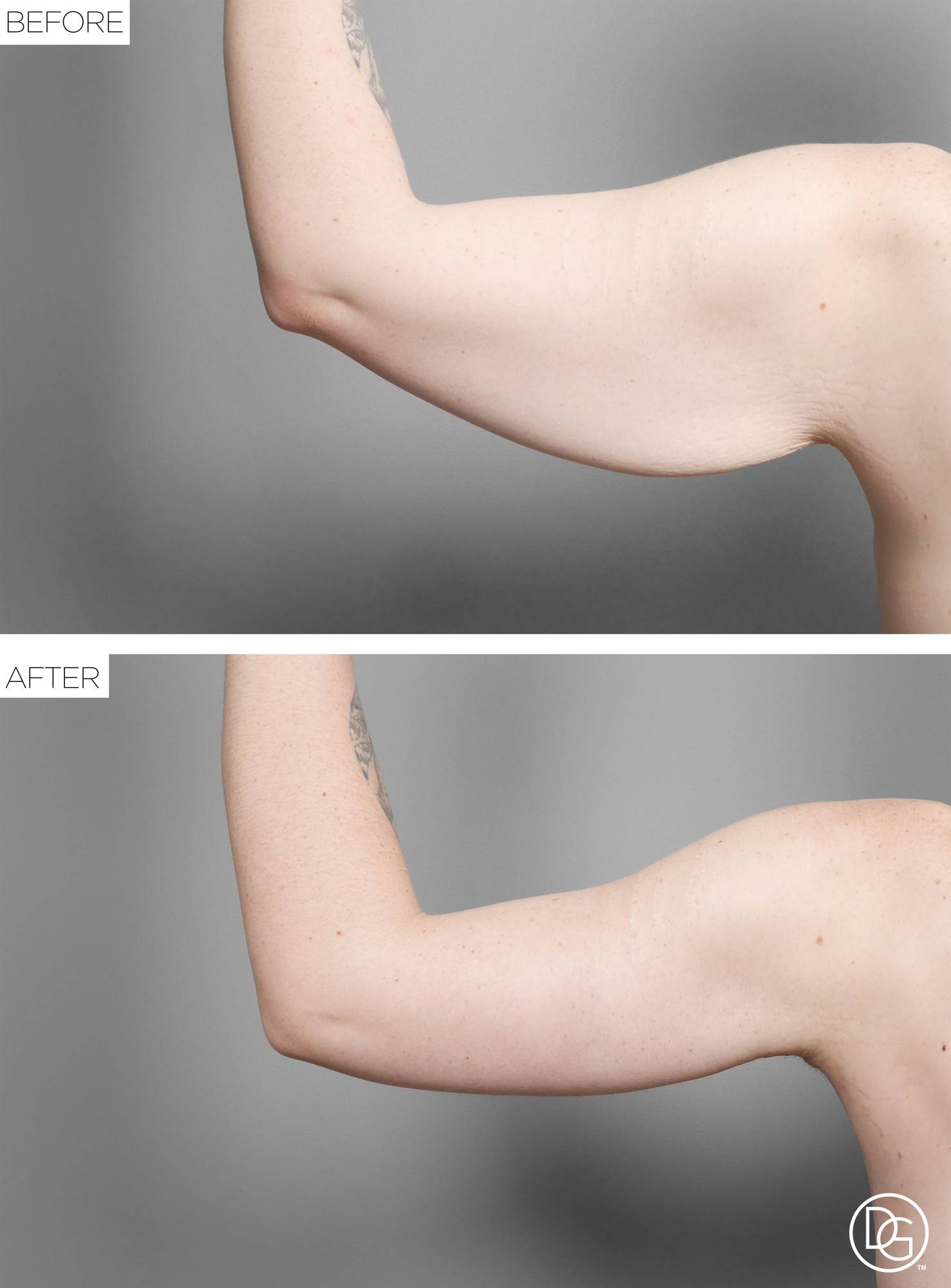 Before & After Image