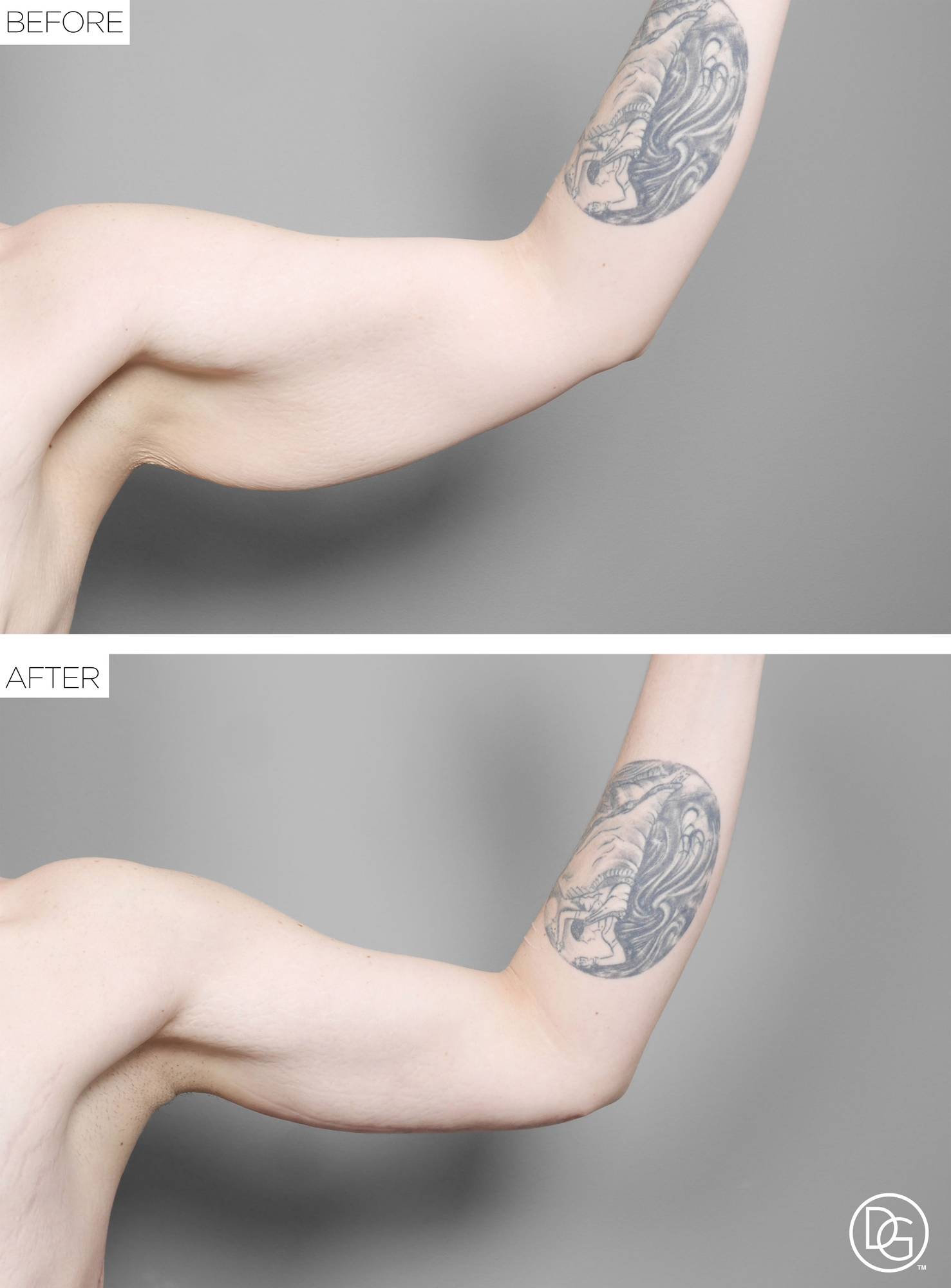 Before & After Image