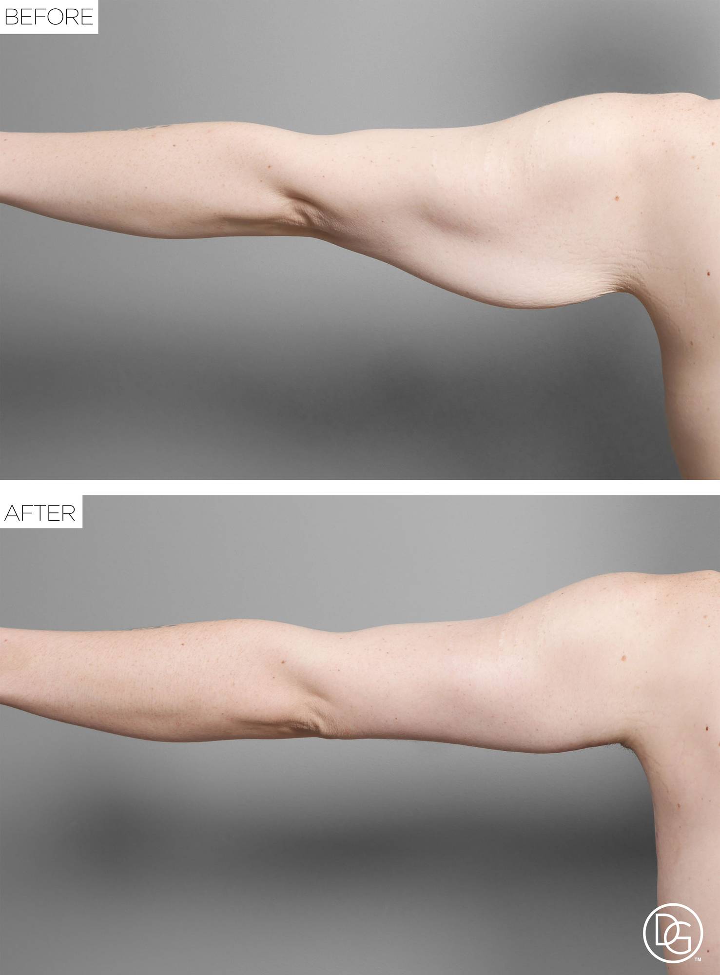 Before & After Image