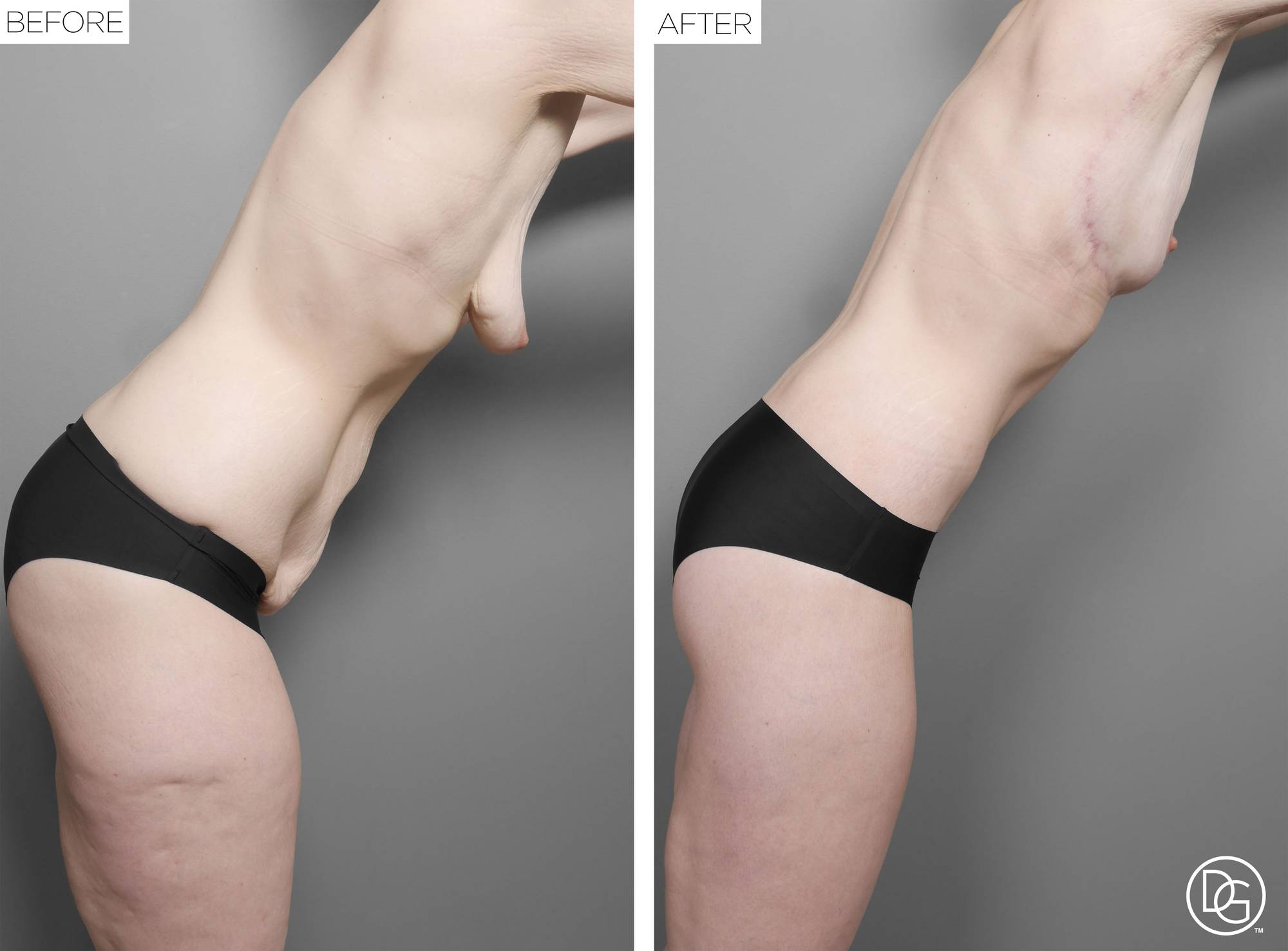 Before & After Image