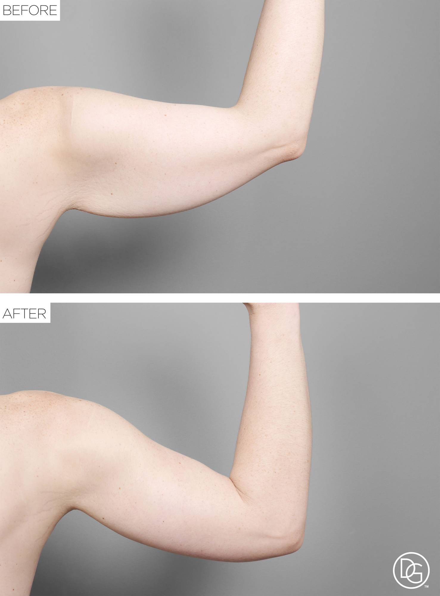 Before & After Image