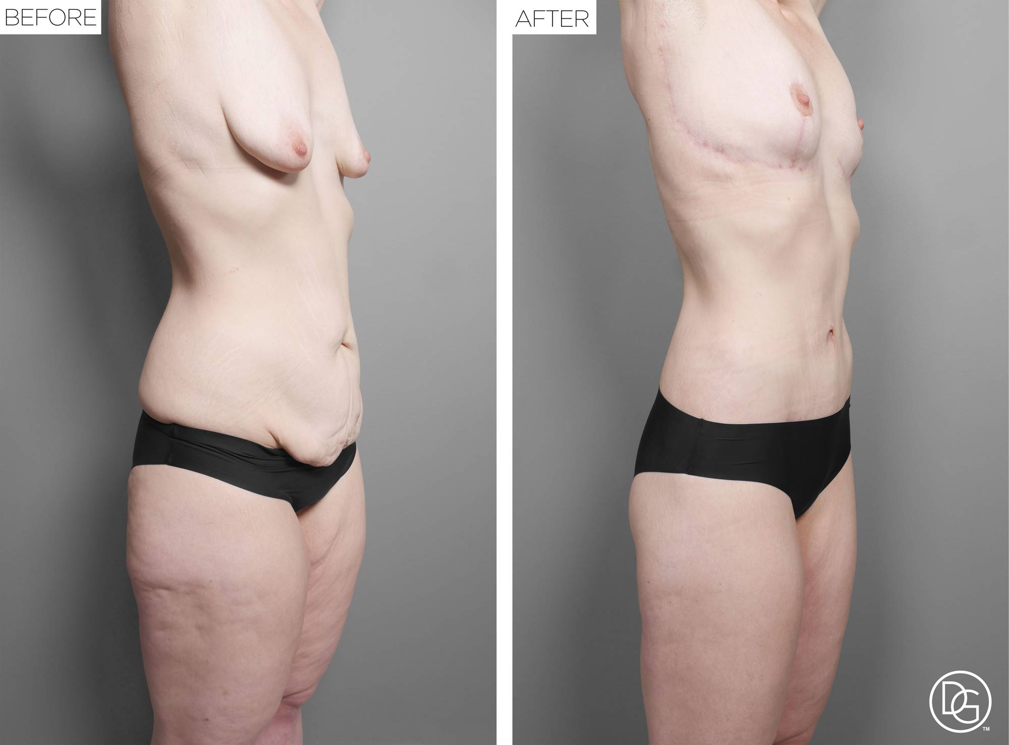 Before & After Image