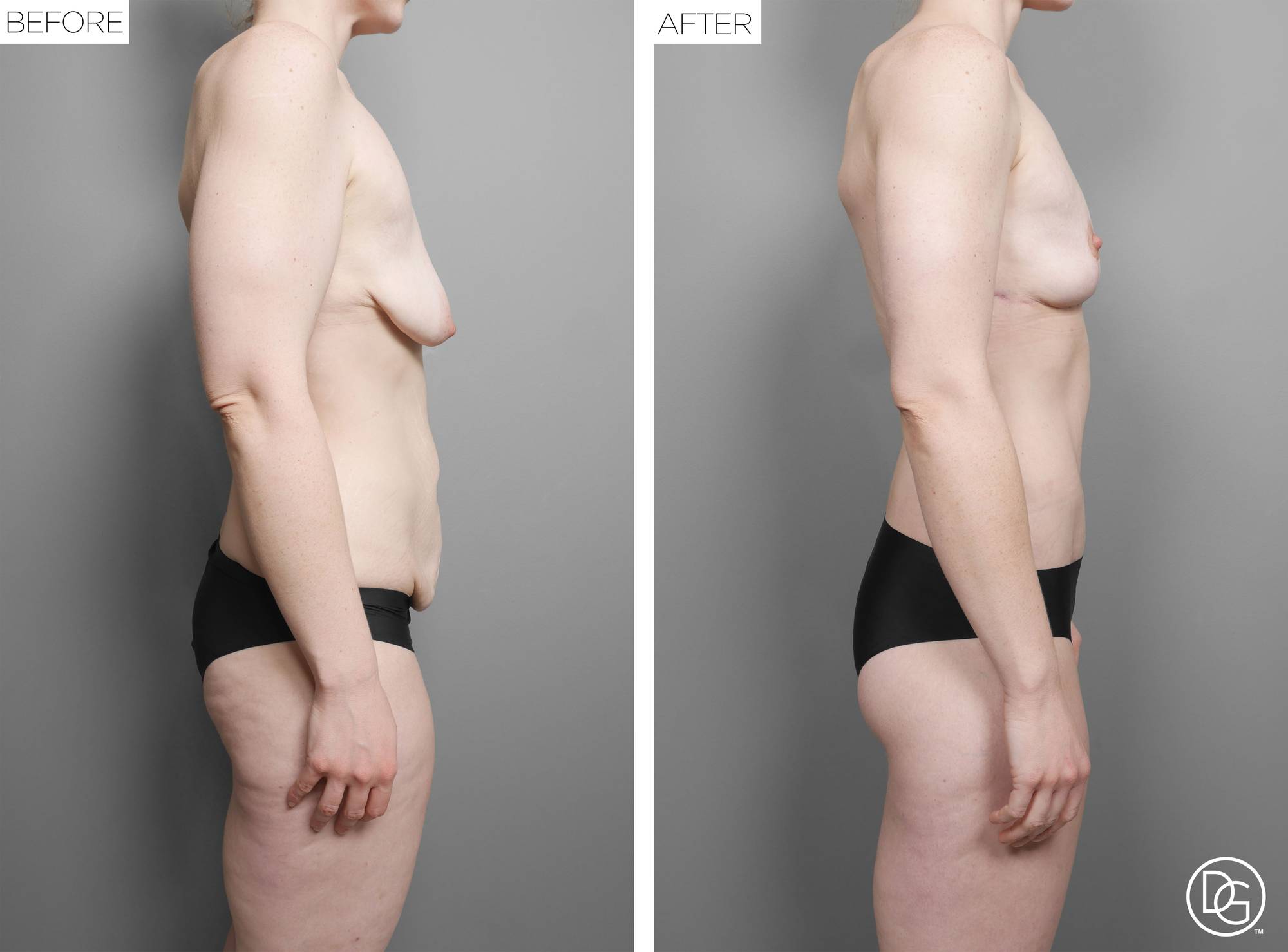 Before & After Image