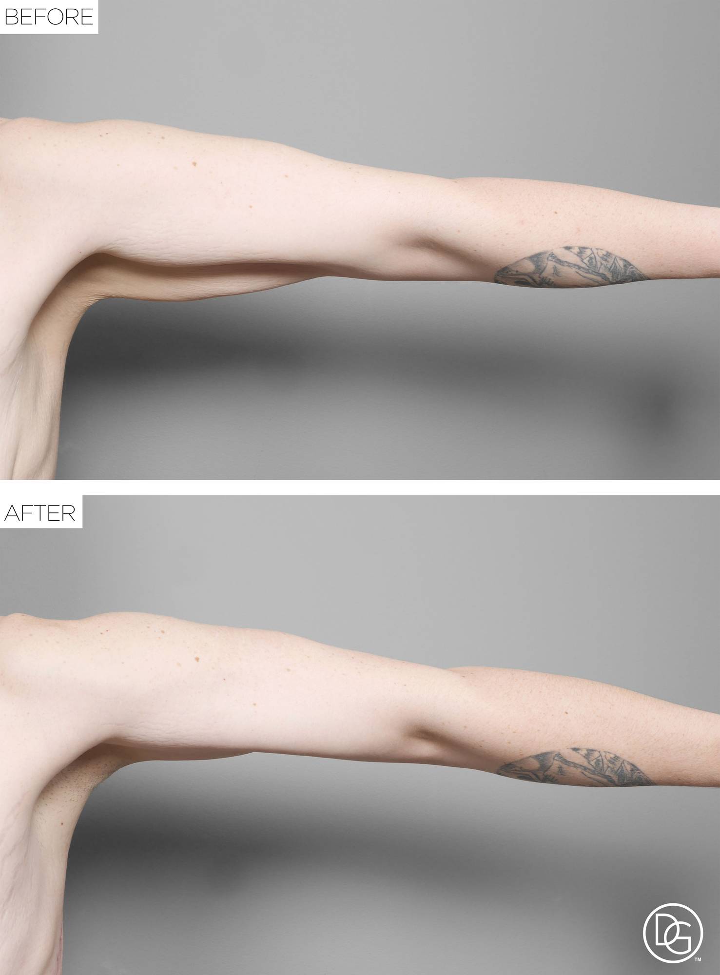 Before & After Image