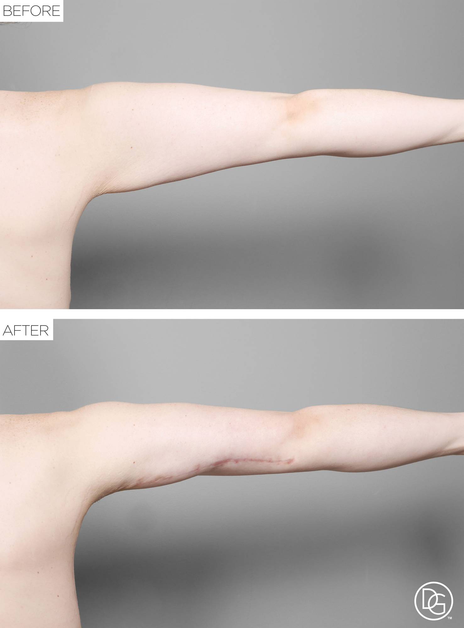 Before & After Image