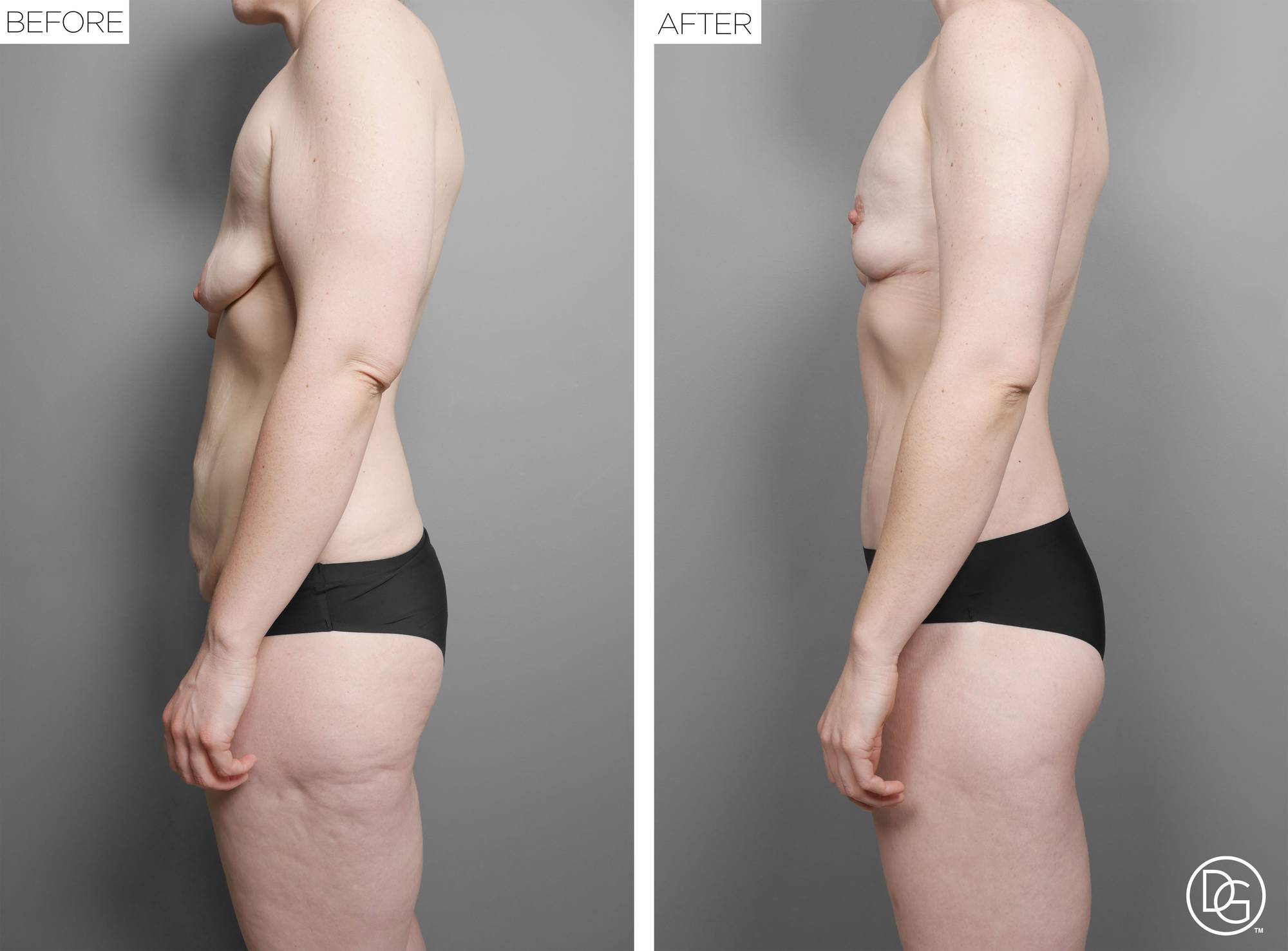 Before & After Image