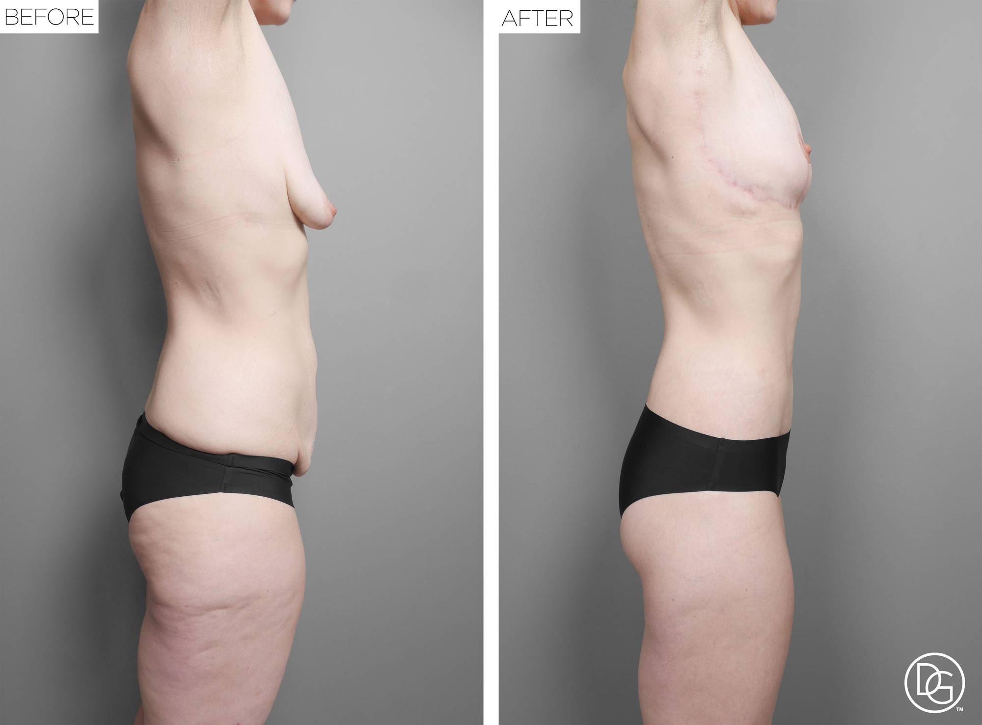 Before & After Image