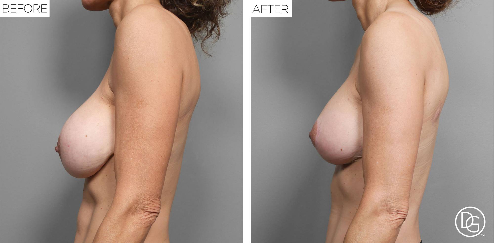 Before & After Image