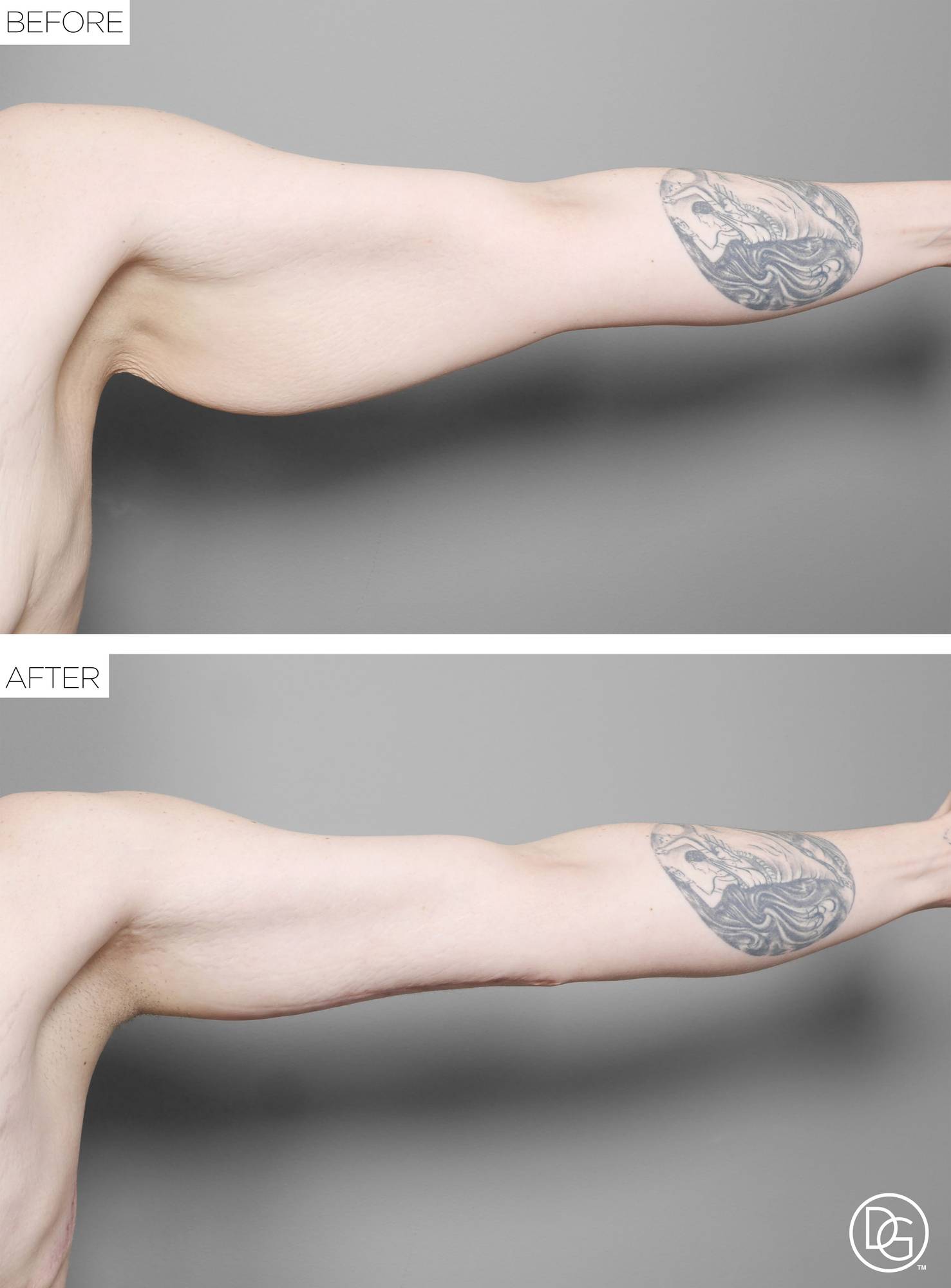 Before & After Image