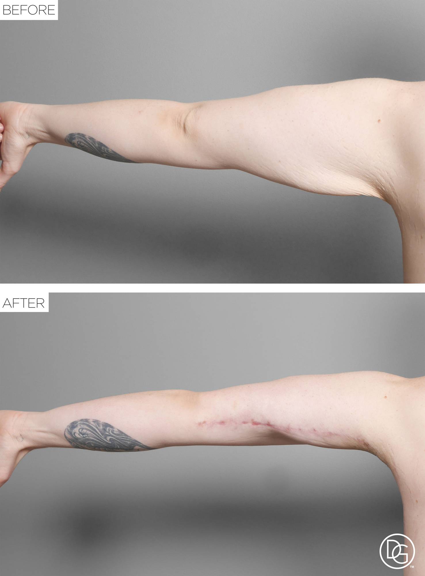 Before & After Image