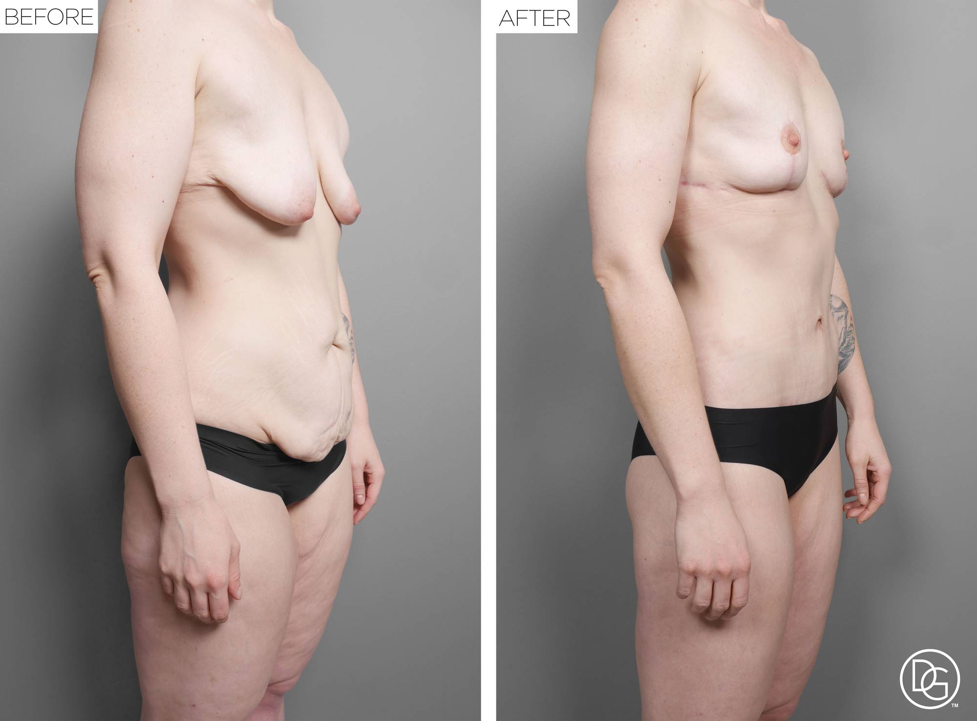 Before & After Image