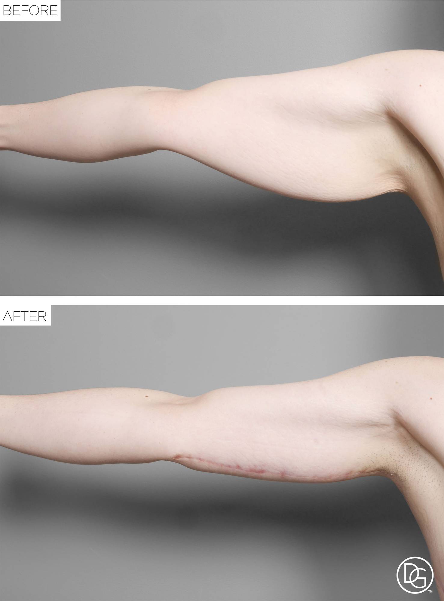 Before & After Image