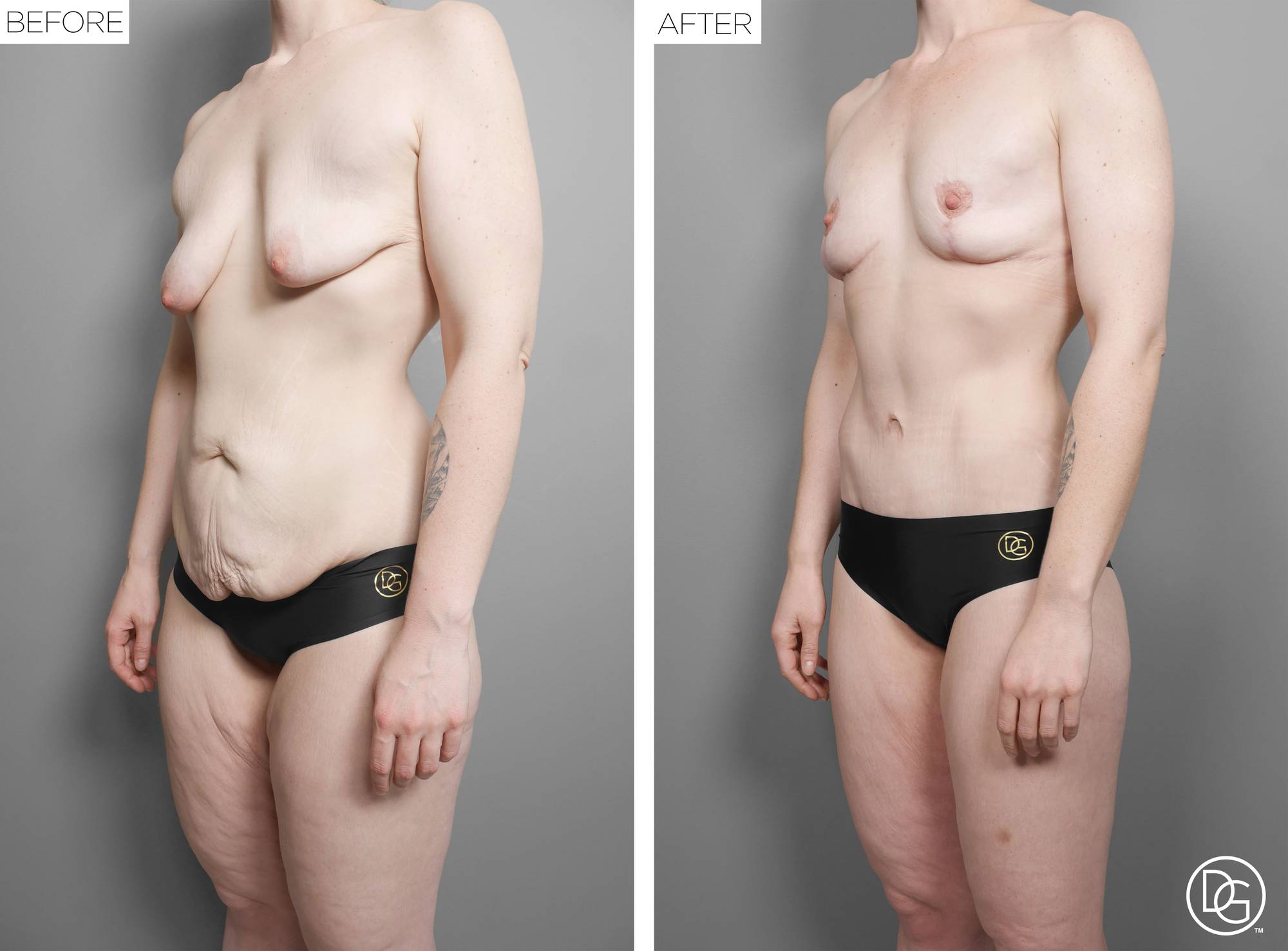 Before & After Image