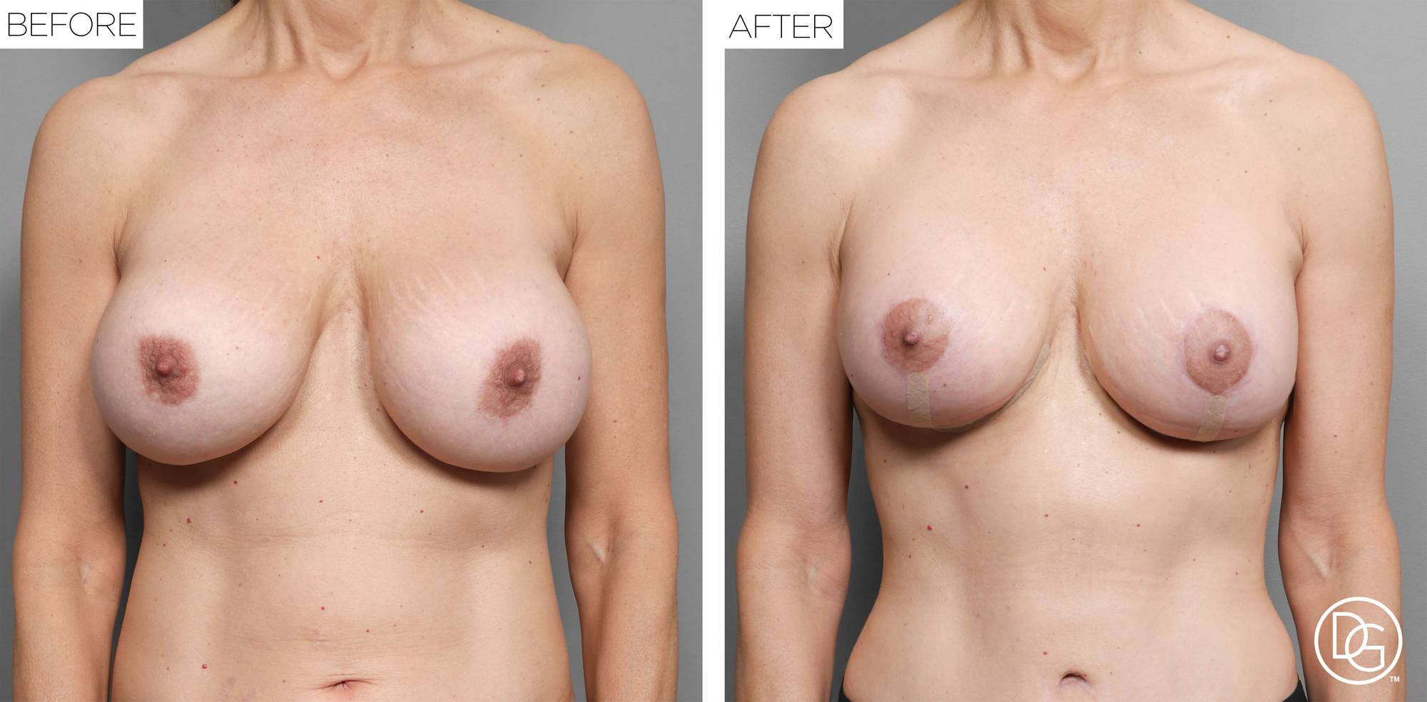 Before & After Image