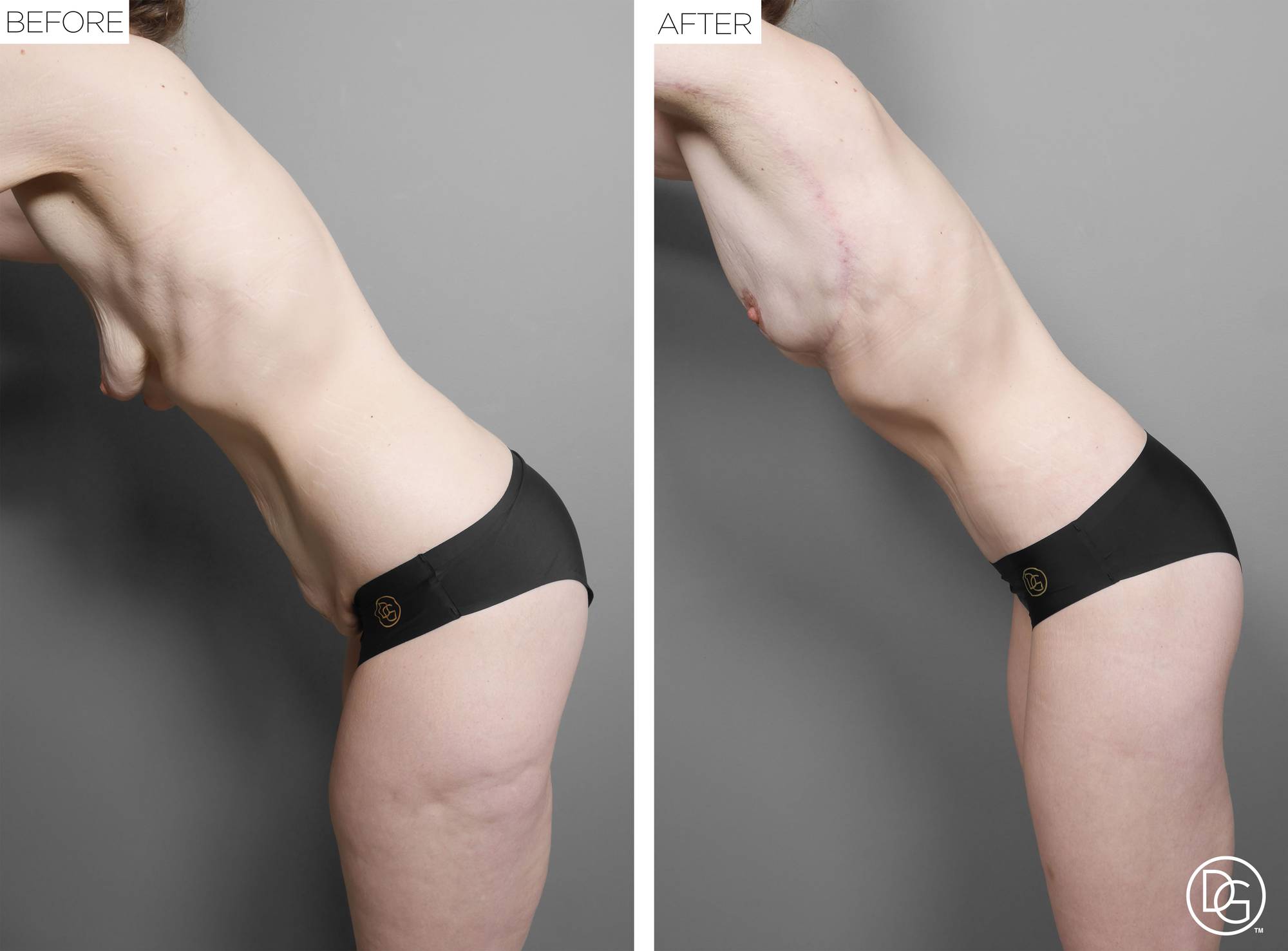 Before & After Image