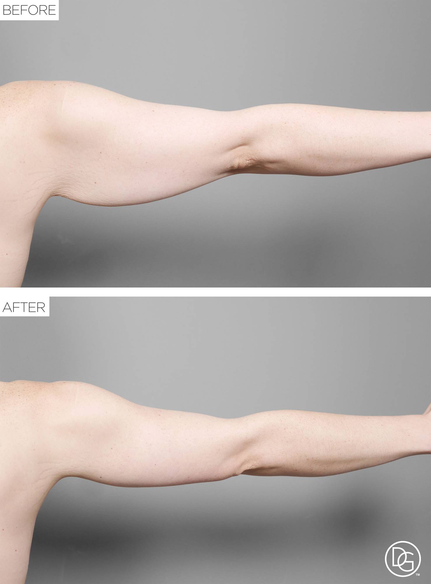 Before & After Image