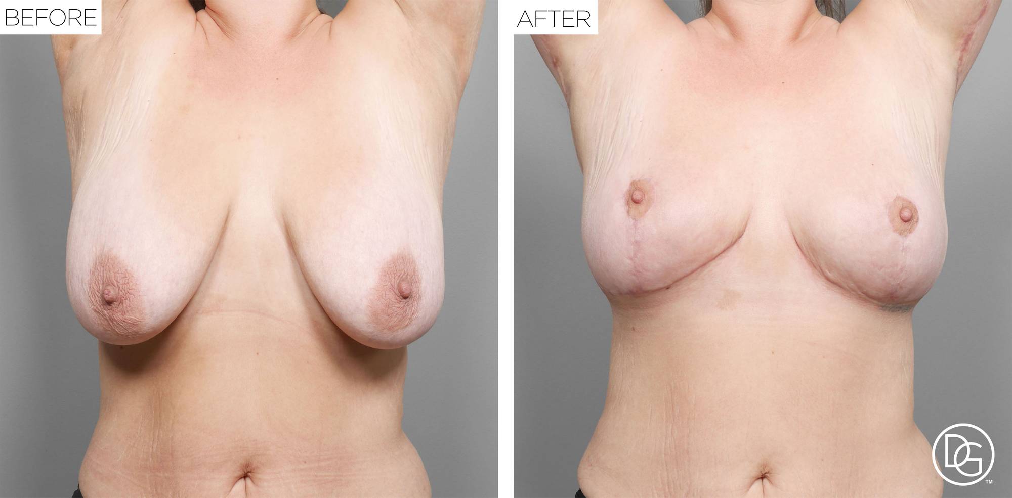 Before & After Image