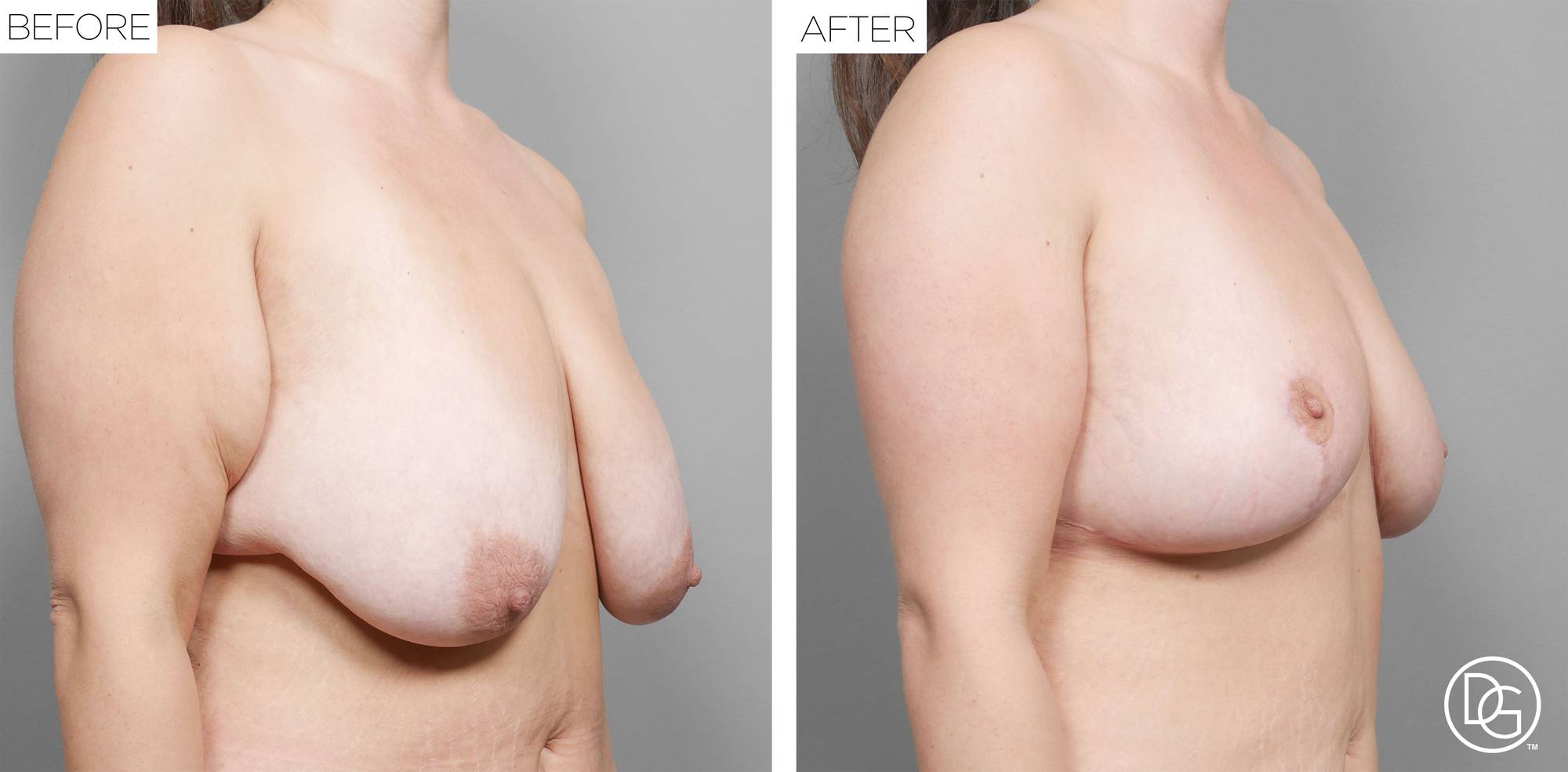 Before & After Image