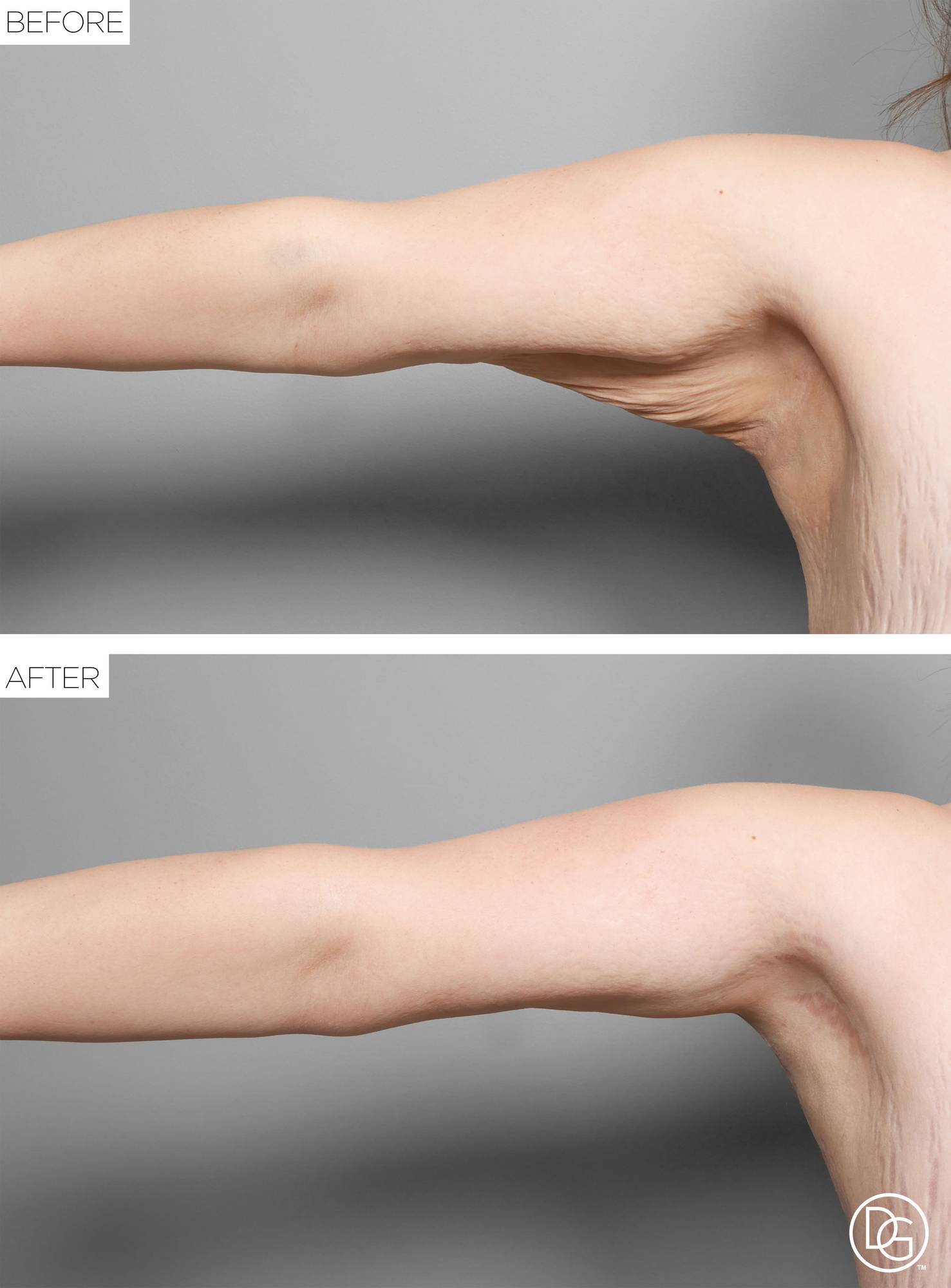 Before & After Image