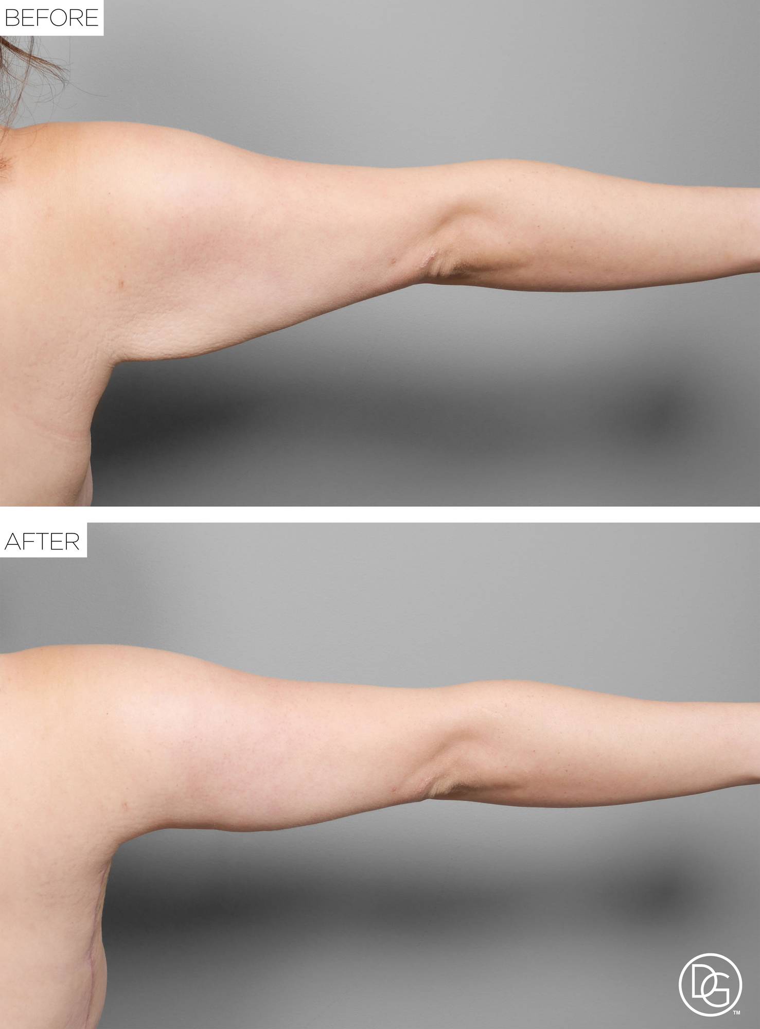 Before & After Image