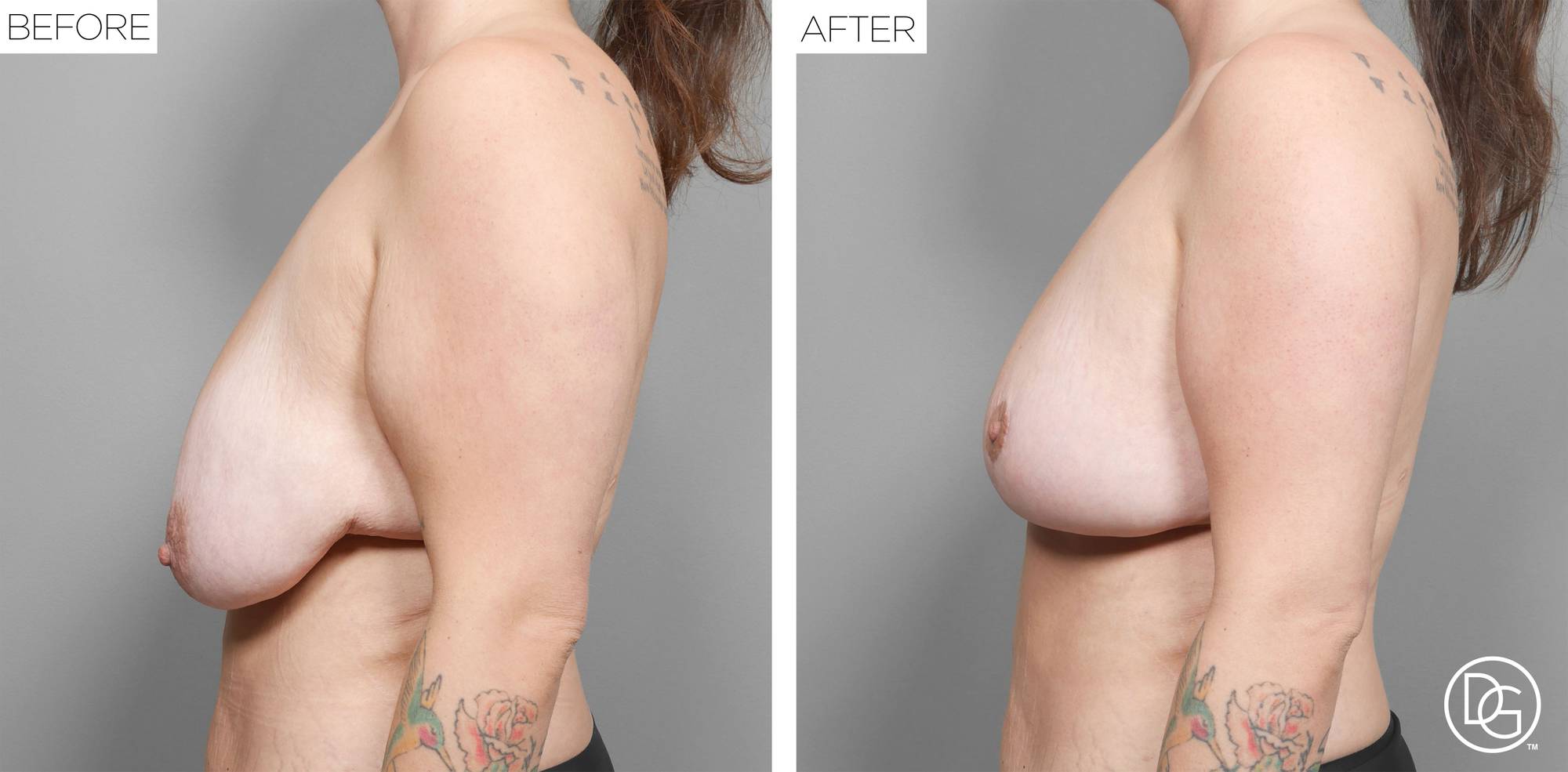 Before & After Image