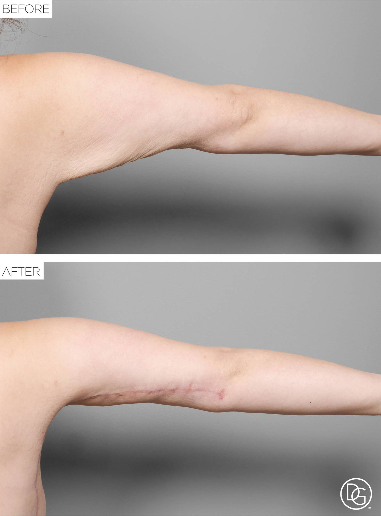 Before & After Image